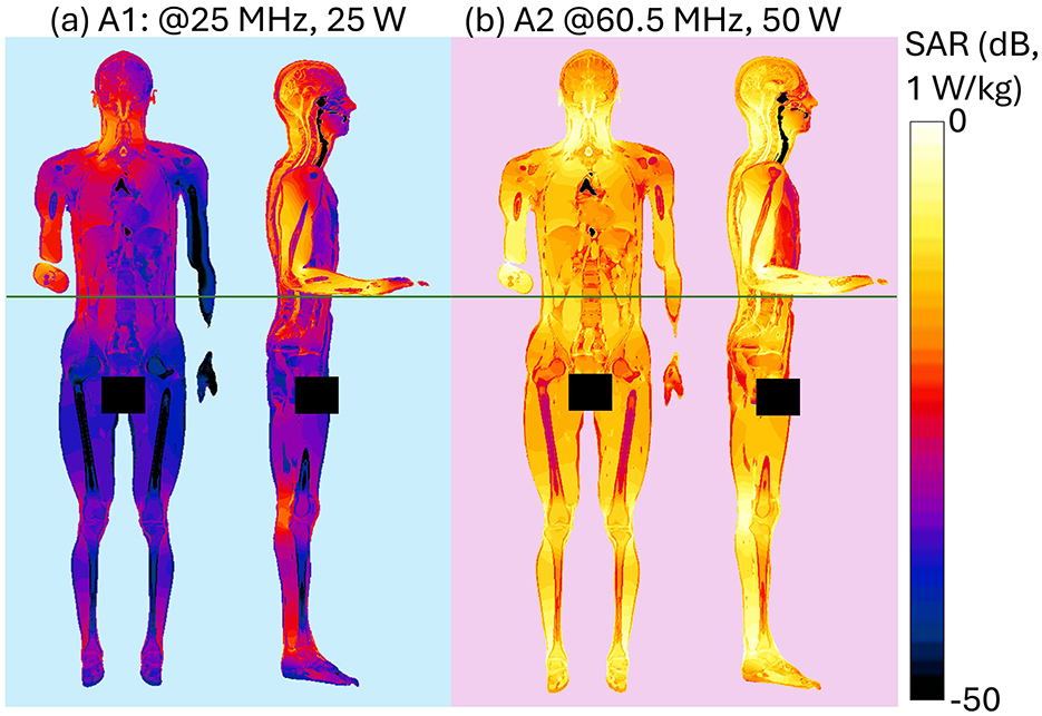 hermal images of human figures showing specific absorption rate (SAR) distribution at two different frequencies and power levels. Panel (a) depicts SAR at 25 MHz and 25 W, with blue and red hues. Panel (b) shows SAR at 60.5 MHz and 50 W, with yellow and orange hues. The SAR scale on the right ranges from 0 dB to -50 dB.