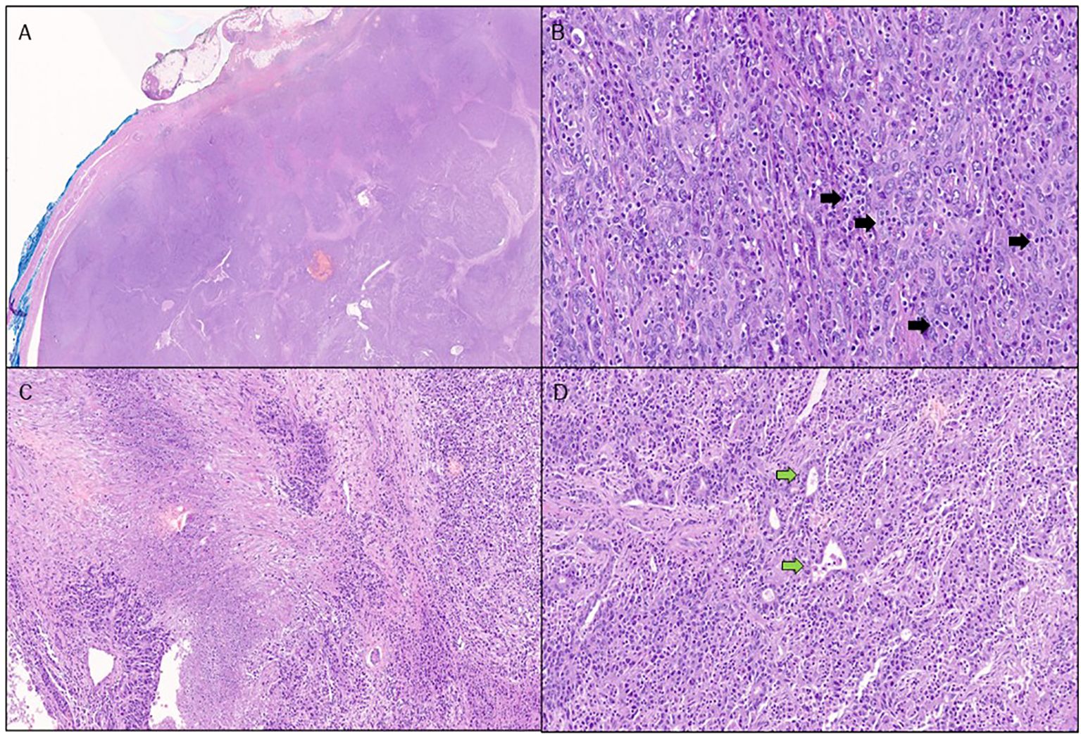 Four-panel microscopic images of tissue sections stained with hematoxylin and eosin. Panel A shows a wide shot of tissue architecture. Panel B highlights cells with arrows indicating specific features. Panel C displays dense cellular areas. Panel D shows cells with green arrows identifying specific structures.