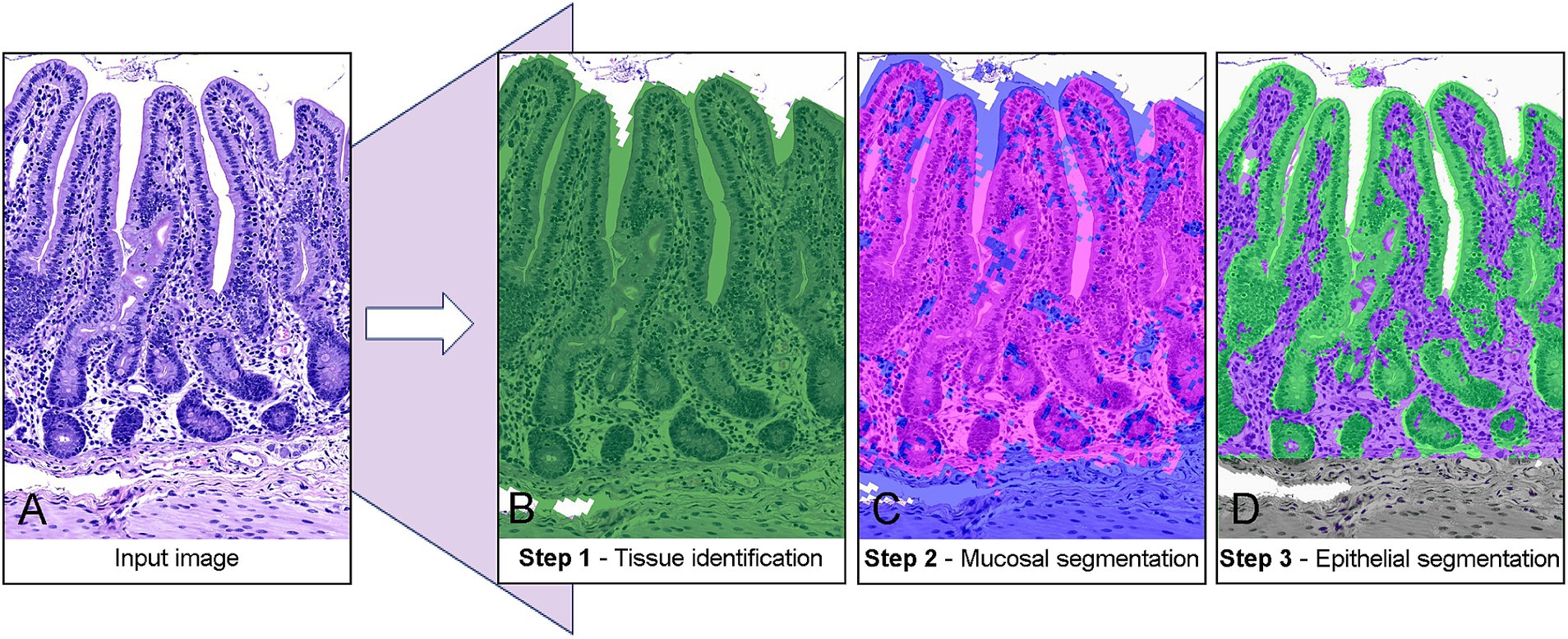 Composite image showing a series of histological section transformations. Image A is the original histological section. Image B shows tissue identification with a green overlay. Image C presents mucosal segmentation highlighted in pink and blue. Image D illustrates epithelial segmentation with purple and green overlays. Arrows indicate the progression between steps.