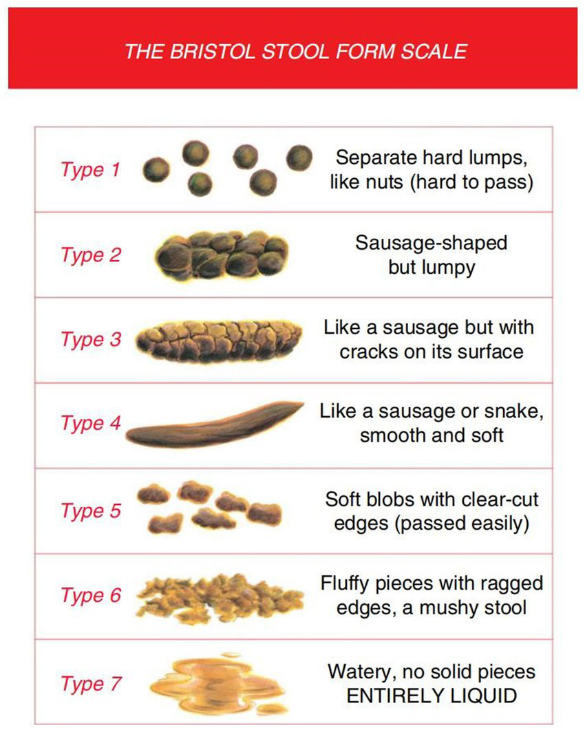 Bristol Stool Form Scale chart showing seven types of stools. Type 1: Separate hard lumps, resembling nuts, difficult to pass. Type 2: Sausage-shaped but lumpy. Type 3: Sausage-like with surface cracks. Type 4: Smooth, soft sausage or snake. Type 5: Soft blobs with clear-cut edges, easy to pass. Type 6: Fluffy pieces with ragged edges, mushy. Type 7: Entirely liquid, no solid pieces.