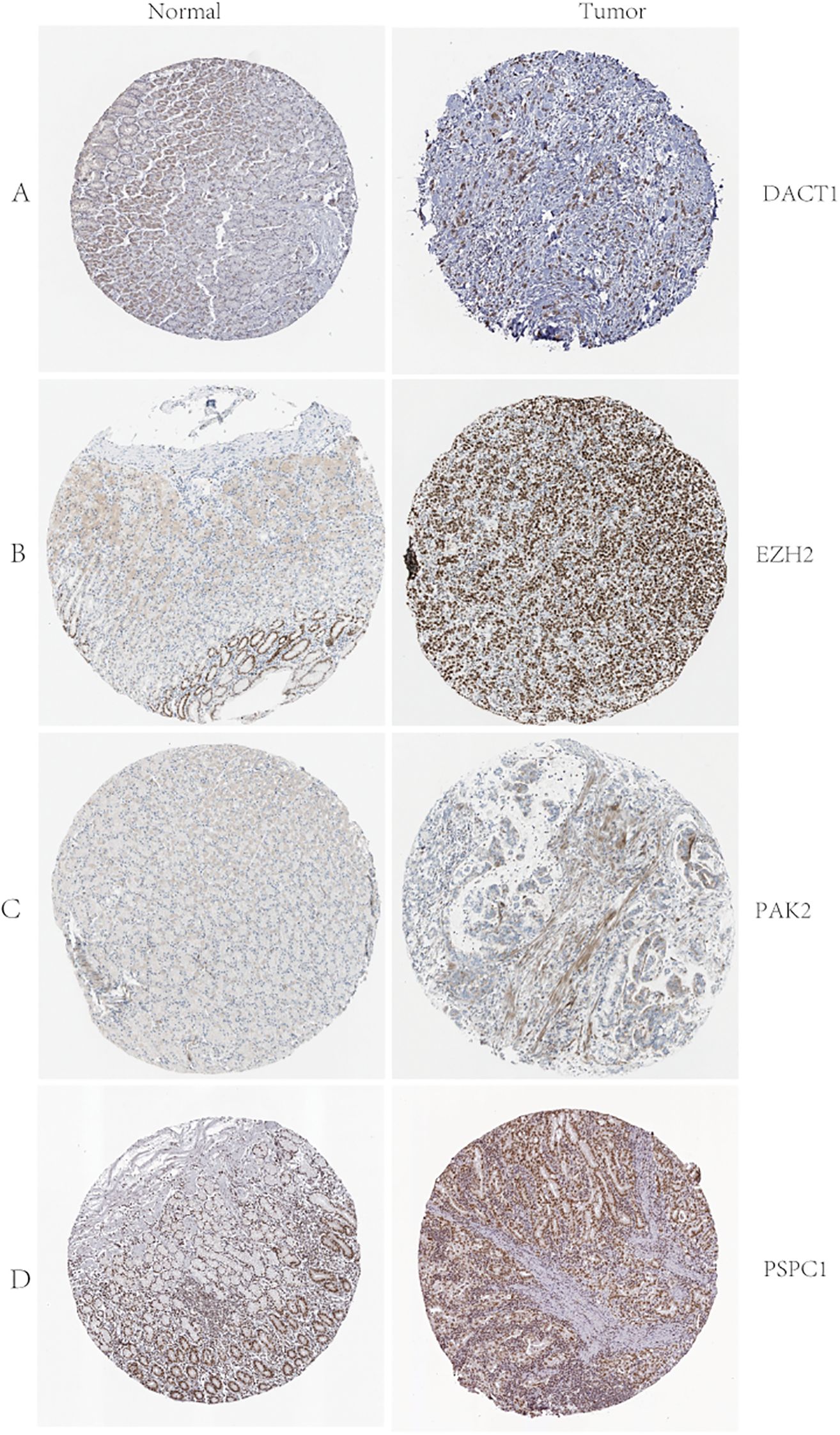 Four pairs of circular tissue section images compare normal and tumor samples for four proteins: DACT1 (A), EZH2 (B), PAK2 (C), and PSPC1 (D). Each row shows a normal sample on the left and a tumor sample on the right, highlighting differences in protein expression.