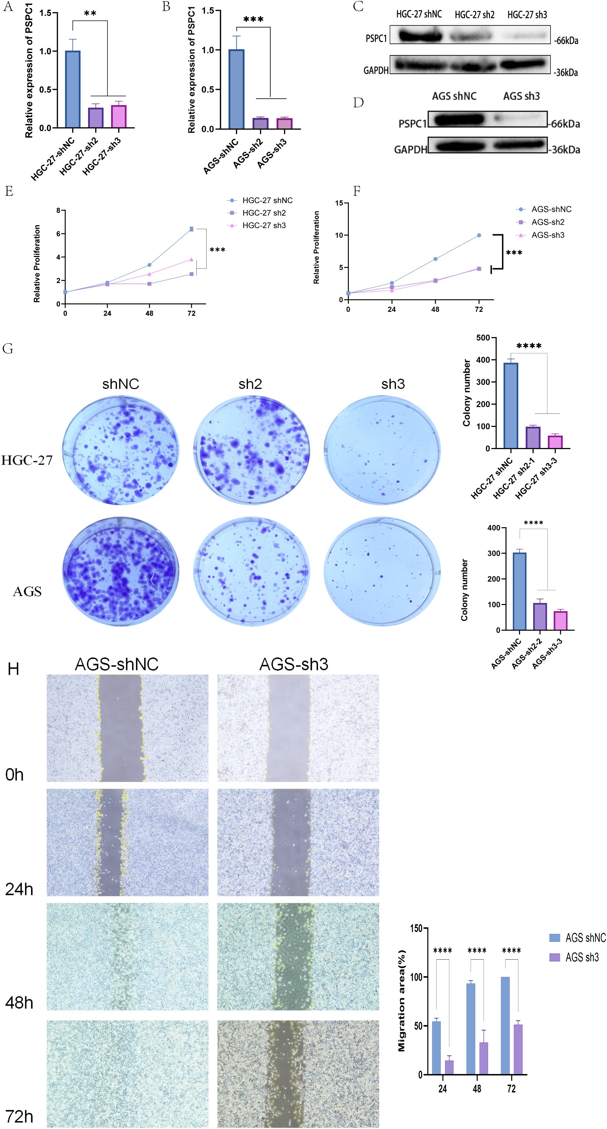 Bar graphs, line charts, western blots, colony formation images, and wound healing assay images are used to illustrate effects of PSPC1 expression on HGC-27 and AGS cells. Bar graphs (A, B) show reduction in PSPC1 expression in sh2 and sh3 treatments. Western blots (C, D) confirm protein expression. Line charts (E, F) display decreased proliferation over 72 hours. Colony formation images and graphs (G) show reduced colonies in knockdown groups. Wound healing assay images and graph (H) illustrate diminished migration in AGS-sh3 compared to control, with analyses at 0, 24, 48, and 72 hours. Statistical significance is indicated with asterisks.