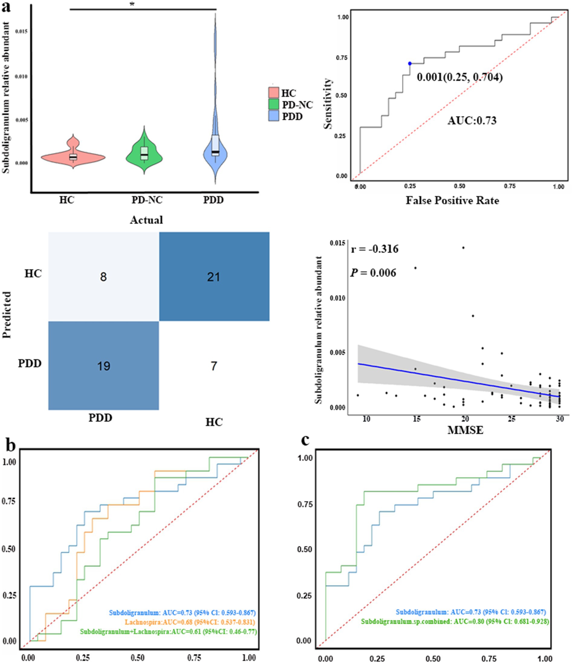 Diagram with multiple panels analyzing subdoligranulum abundance in different groups. Panel a includes a violin plot and a confusion matrix for healthy controls (HC), Parkinson's Disease with normal cognition (PD-NC), and Parkinson’s Disease Dementia (PDD), as well as a ROC curve with AUC 0.73. Panel b shows ROC curves for subdoligranulum, lachnospira, and a combination, with AUC values. Panel c presents another ROC curve for subdoligranulum alone and combined, with AUCs of 0.73 and 0.80. Scatter plot indicates negative correlation between subdoligranulum abundance and MMSE score.