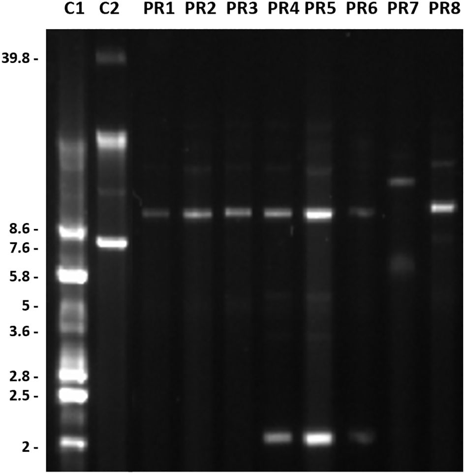 Gel electrophoresis image showing DNA bands across lanes labeled C1, C2, PR1 to PR8. Lanes indicate molecular weight markers on the left and bands of varying intensities and positions across the lanes.