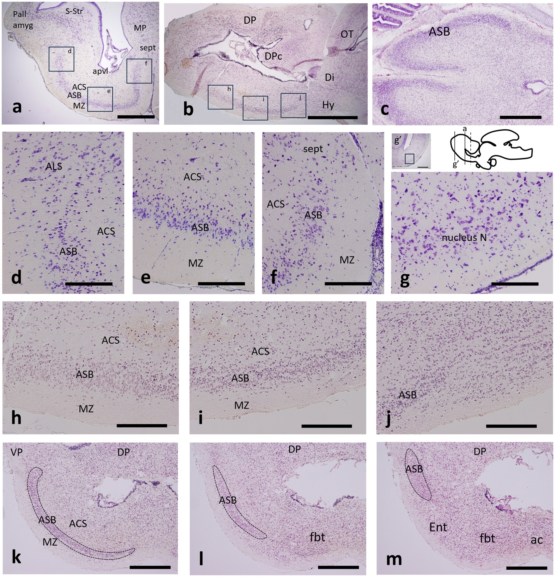 Histological sections depicting various brain regions with labels indicating specific areas such as ALS, ACS, ASB, MZ, and others. The images are marked with letters from a to m, showing different views and magnifications. Scale bars provide reference for size.