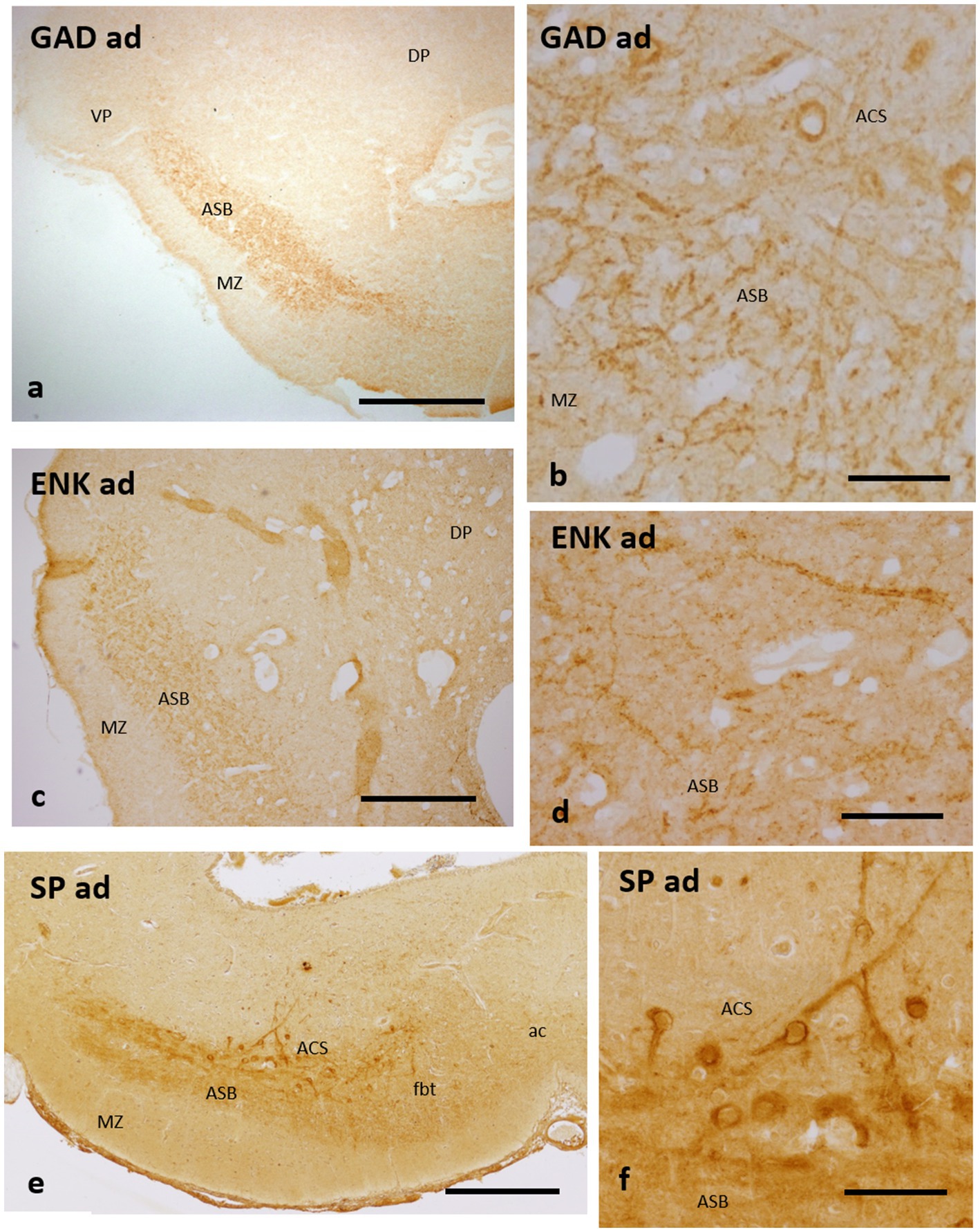 Six histological images labeled a to f, showing brain sections with different staining methods: GAD ad (a, b), ENK ad (c, d), SP ad (e, f). Regions like ASB, MZ, DP, ACS, VP, fbt, and ac are marked. Scale bars are present for reference.