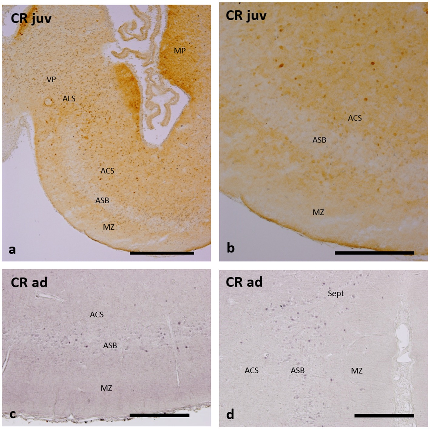 Four-panel histological images labeled a, b, c, and d showing CR juv and CR ad brain tissue sections. Panels a and b display juvenile tissue with labeled areas: MP, VP, ALS, ACS, ASB, MZ. Panels c and d show adult tissue with areas ACS, ASB, MZ, and Sept marked. Each panel has a scale bar at the bottom.