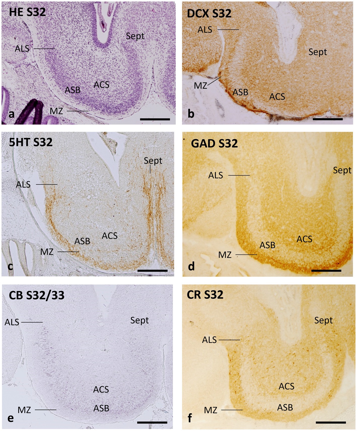 Histological images displaying sections of catshark brain tissue stained with different markers. Each image, labeled from a to f, shows distinct staining patterns corresponding to various markers: HE, DCX, 5HT, GAD, CB, and CR. Key anatomical areas labeled include ALS, MZ, ASB, ACS, and Sept. Each image highlights specific cellular structures and regions, indicated by the labels, with variations in color and density of staining. Black scale bars provide reference for size.