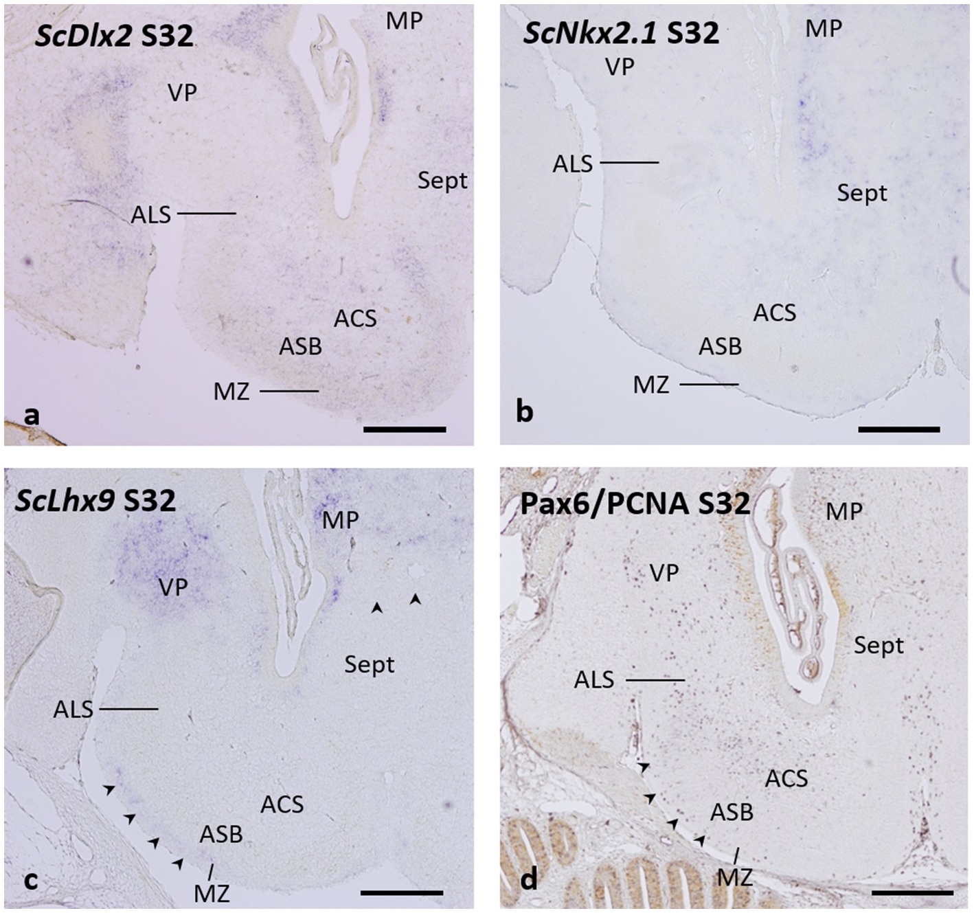 Four microscopic images labeled a, b, c, and d, showing sections with annotations: ScDlx2 S32, ScNkx2.1 S32, ScLhx9 S32, and Pax6/PCNA S32. Key regions are labeled: MP, VP, Sept, ALS, ACS, ASB, and MZ. Arrows and lines indicate specific areas of interest. Each image has a scale bar for reference.