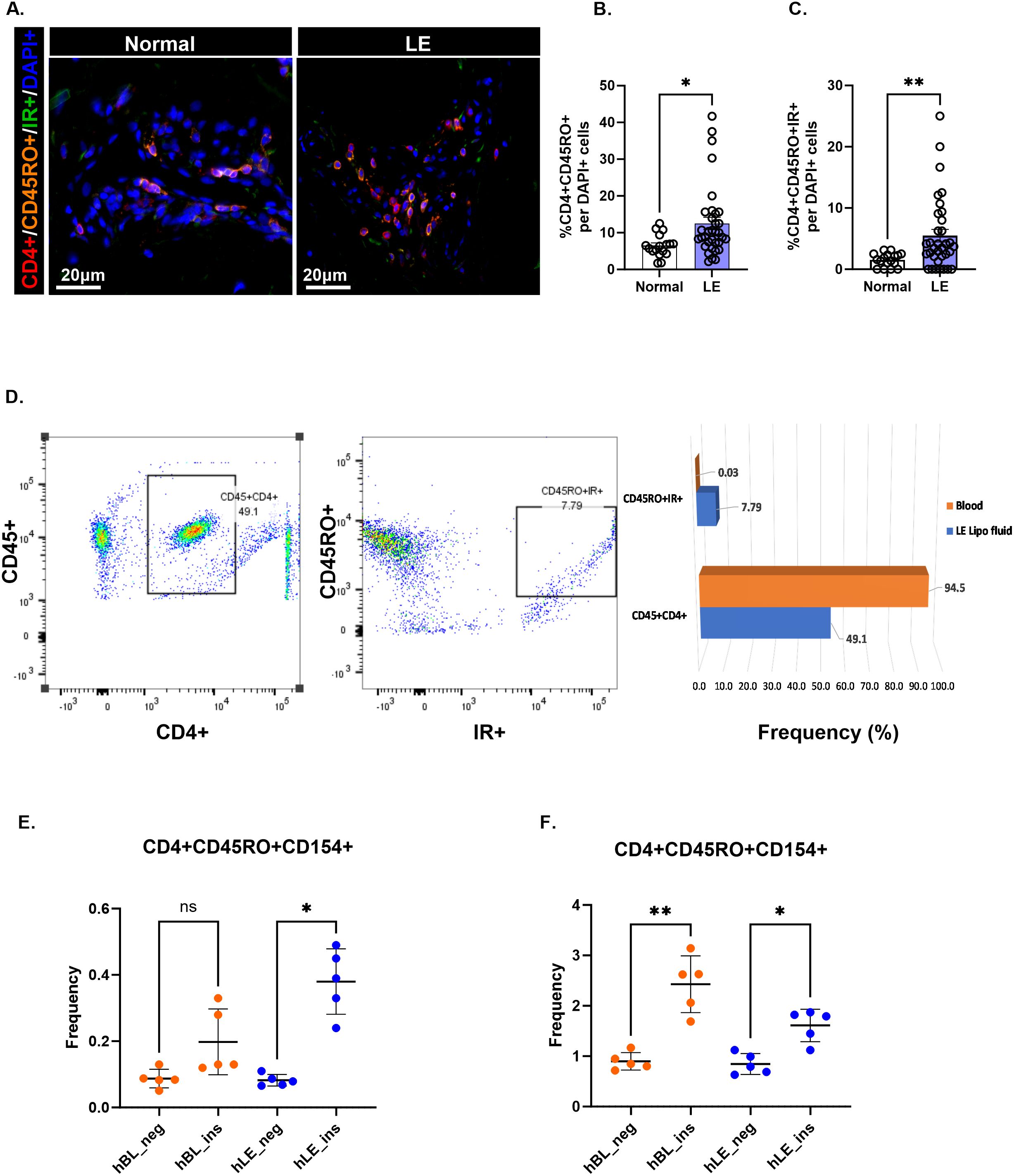 Panel A shows immunofluorescence images comparing normal and LE samples, highlighting CD4, CD45RO, and IR markers. Panels B and C display bar graphs quantifying CD4+CD45RO+ and CD4+CD45RO+IR+ cells respectively, with significant differences indicated. Panel D includes flow cytometry plots and a corresponding bar graph comparing CD45+CD4+ and CD45RO+IR+ cells in blood and LE lipo fluid. Panels E and F present bar graphs depicting the frequency of CD4+CD45RO+CD154+ cells under different conditions, with statistical significance shown.