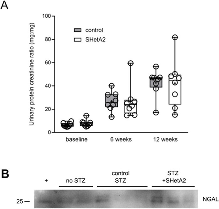 Chart A is a box plot showing urinary protein creatinine ratios at baseline, six weeks, and twelve weeks for control and SHetA2 groups. Chart B is a western blot displaying NGAL levels under different treatment conditions: no STZ, control STZ, and STZ with SHetA2.