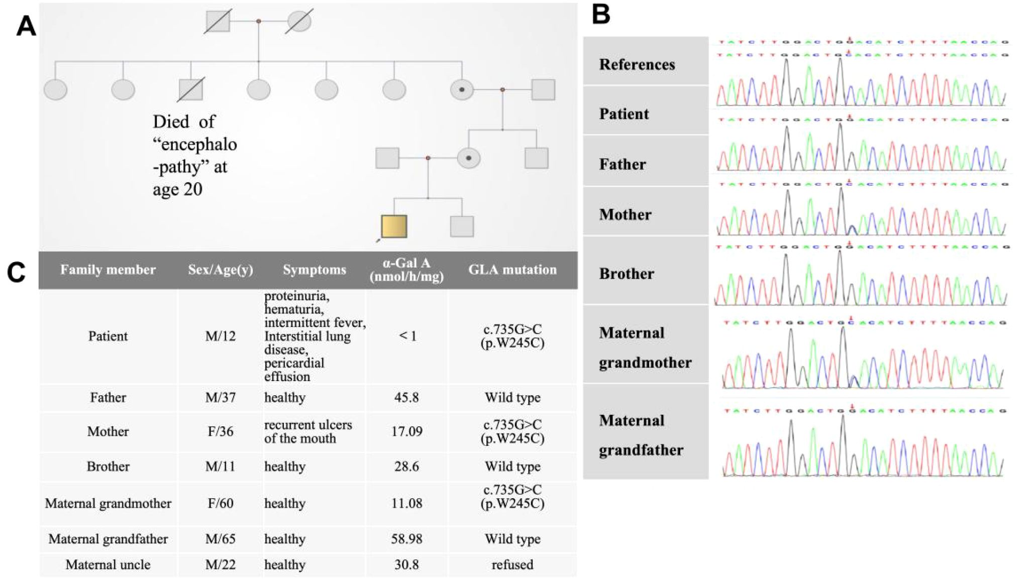 A genetic analysis diagram depicting a family pedigree, chromatogram, and table. Panel A shows a family pedigree indicating a deceased member at age 20 from “encephalopathy.” Panel B displays chromatograms for the family, showing genetic sequences corresponding to each member. Panel C is a table listing family members with details on sex, age, symptoms, α-Gal A levels, and GLA mutation status. The patient, a 12-year-old male, shows symptoms like proteinuria and has a specific GLA mutation (c.735G>C). Other members are noted as healthy or show different symptoms and mutation statuses.