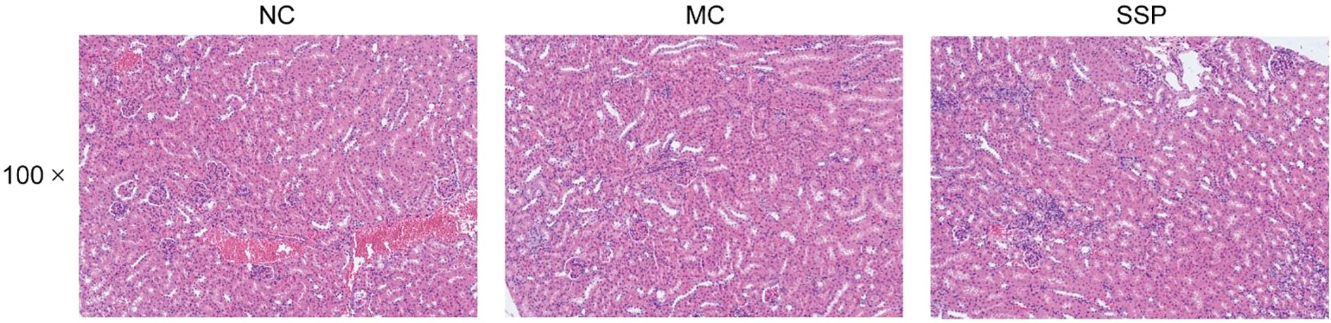 Three microscope images show histological samples labeled NC, MC, and SSP at 100 times magnification. Each sample displays varying tissue structures in shades of pink and purple, indicating different staining patterns or conditions.