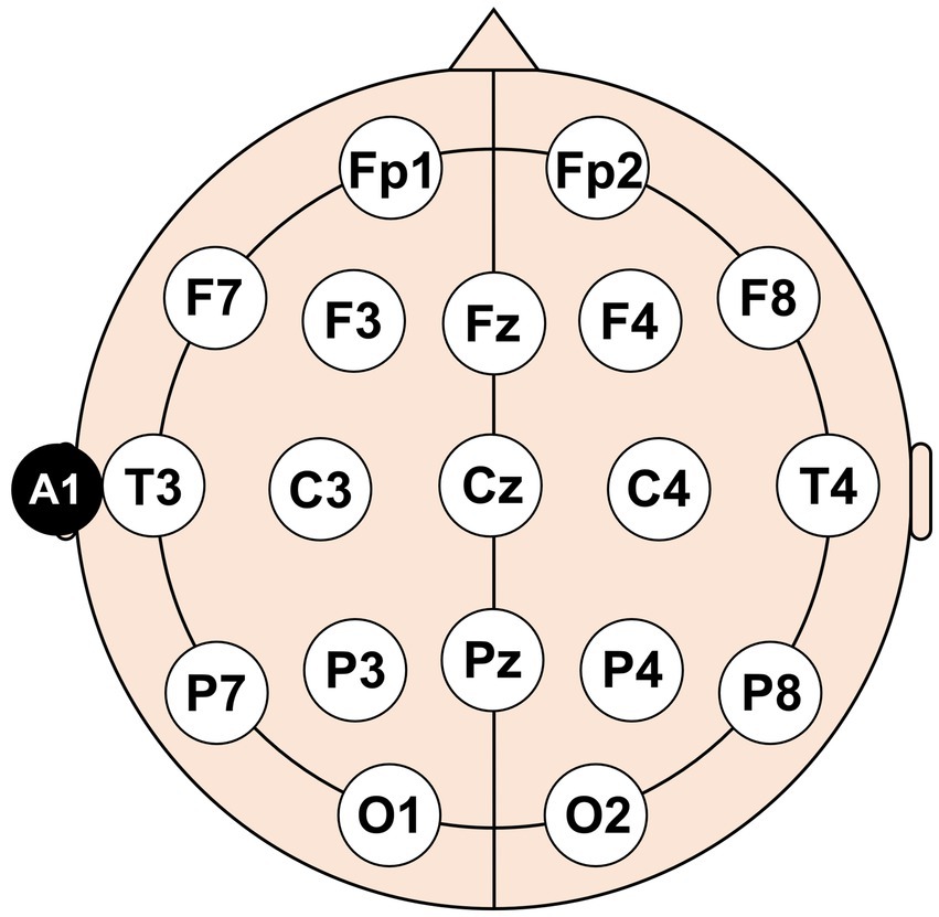 Diagram of a circular 10-20 EEG electrode placement system on a head. Electrode positions are labeled as Fp1, Fp2, F7, F3, Fz, F4, F8, T3, C3, Cz, C4, T4, P7, P3, Pz, P4, P8, O1, O2, and A1.