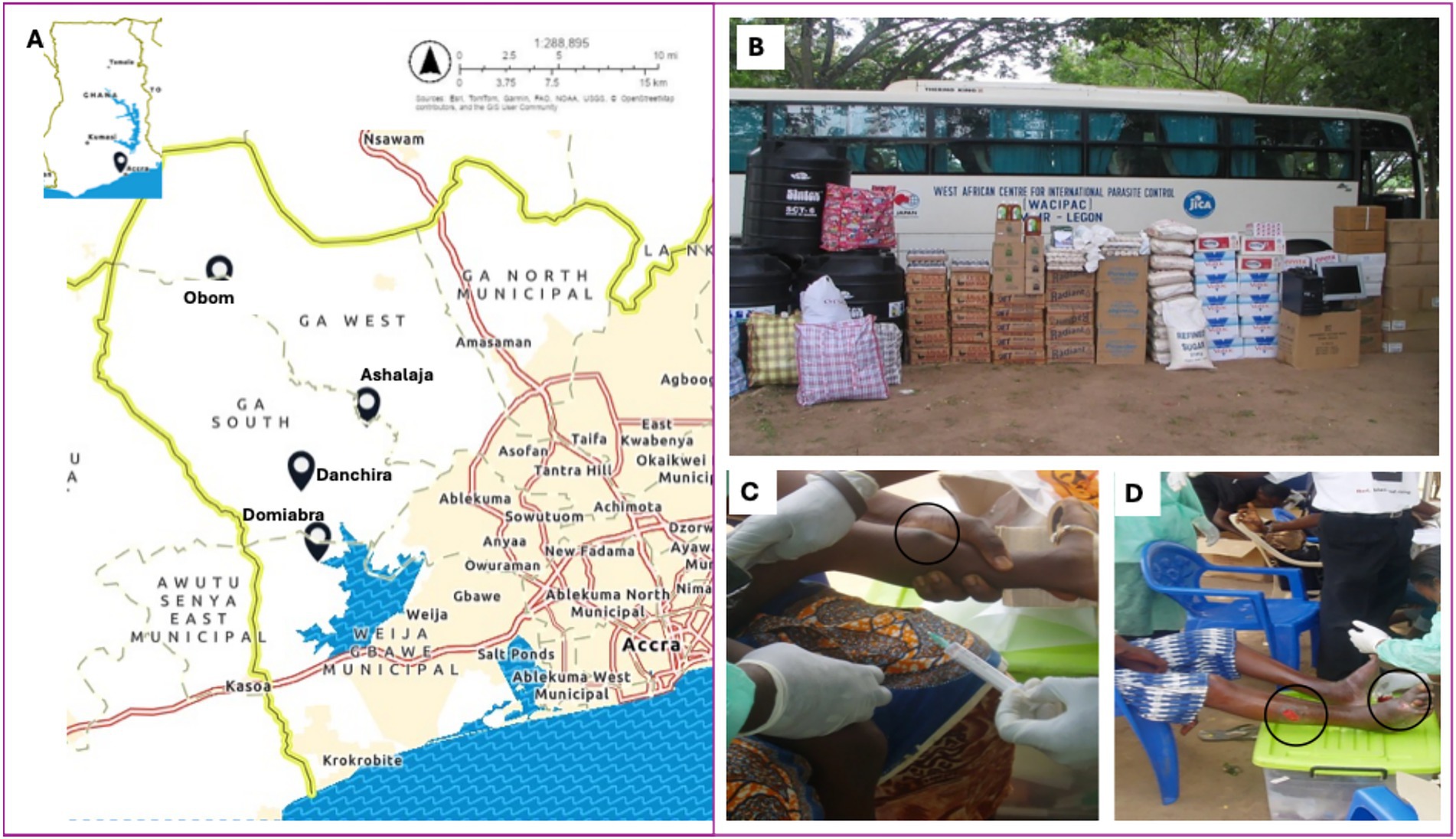 A four-panel image is shown. Panel A features a map highlighting areas such as Nsawam, Obom, Ashalaja, Danchira, and Domiabra near Accra, Ghana. Panel B displays a bus from the West African Centre for International Parasite Control with assorted supplies, including boxes and large bags, stacked alongside it. Panel C illustrates a close-up of a vaccination being administered to a person’s arm by a gloved medical worker. Panel D shows a medical worker attending to a person seated on a blue chair, focusing on treatment of leg wounds.
