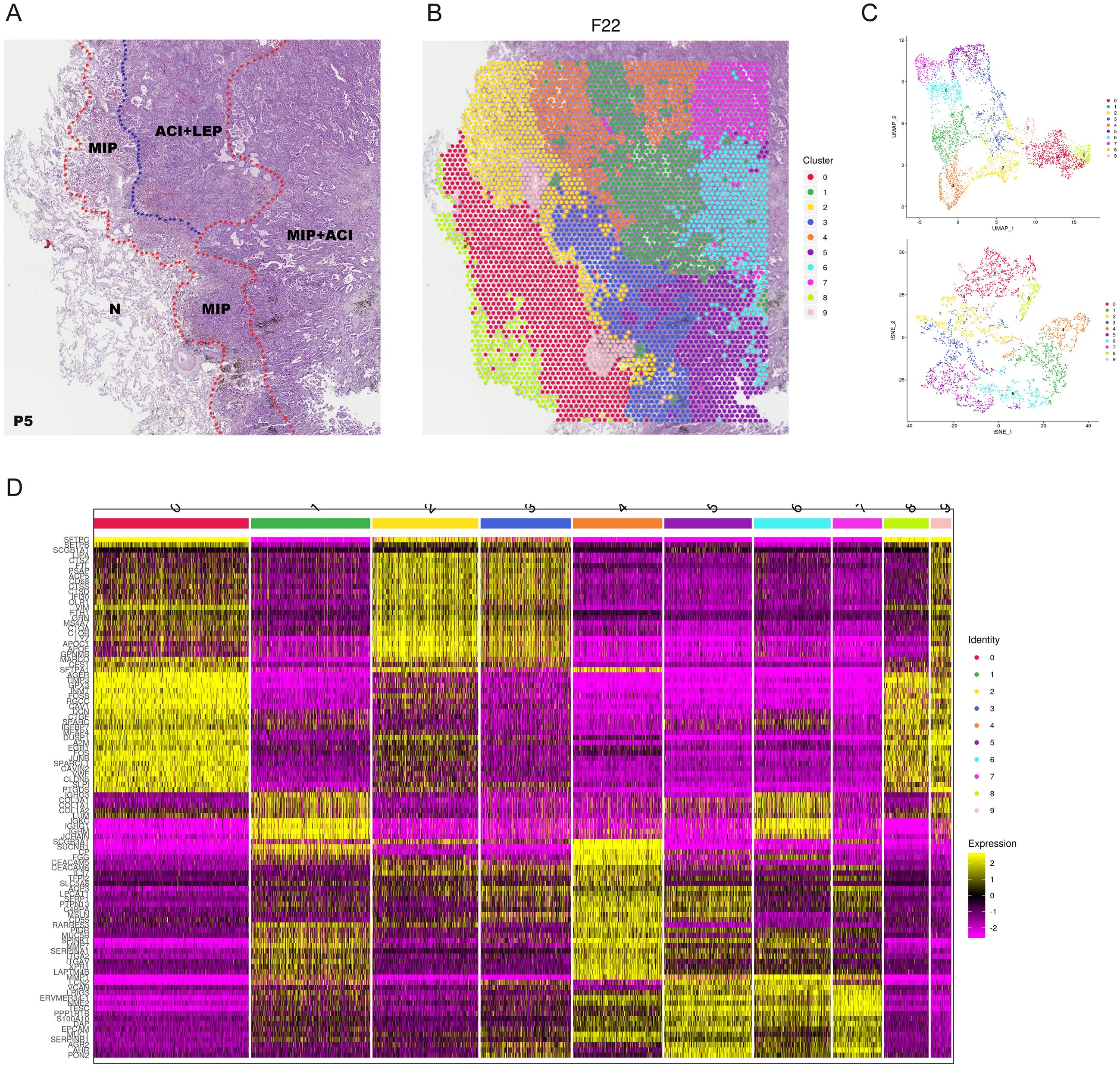 Panel A shows a histological tissue sample with labeled regions, including MIP, ACI+LEP, and N. Panel B illustrates a clustered map with color-coded regions from zero to seven. Panel C presents two scatter plots showing cluster distributions. Panel D is a heatmap displaying gene expression data, color-coded with yellow and pink, correlating to expression levels and identities from zero to eight.