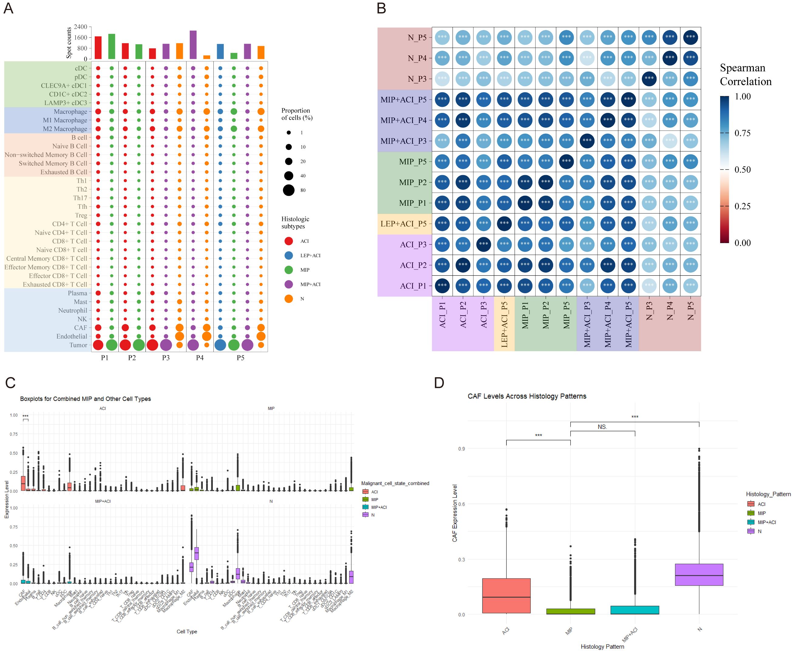 Panel A is a bar and dot plot showing cell proportions across five samples, sorted by cell type and histology subtype. Panel B displays a heatmap of Spearman correlations among different groups, marked by varying shades of blue. Panel C features boxplots comparing expression levels of combined malignant cell states across different cell types. Panel D presents boxplots of CAF expression levels across four histology patterns, illustrating statistical significance.