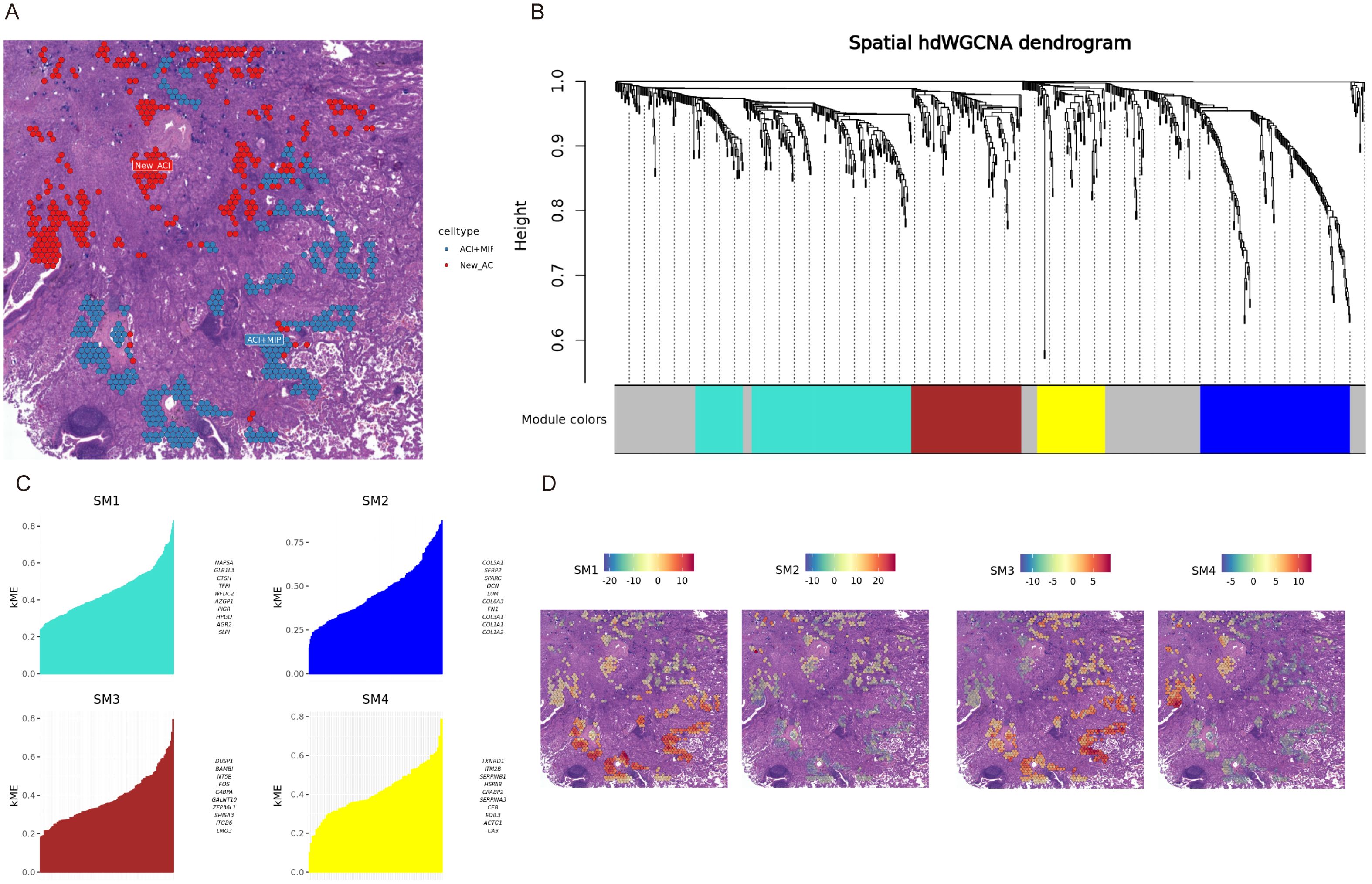 Panel A shows a tissue section with regions highlighted in red and blue hexagons representing different cell types. Panel B depicts a spatial hdWGCNA dendrogram with module color bars in gray, cyan, red, yellow, and blue. Panel C includes four bar graphs (SM1 to SM4) showing KME values for different genes. Panel D features four images of tissue sections colored according to SM1 to SM4 value gradients, ranging from blue to red.