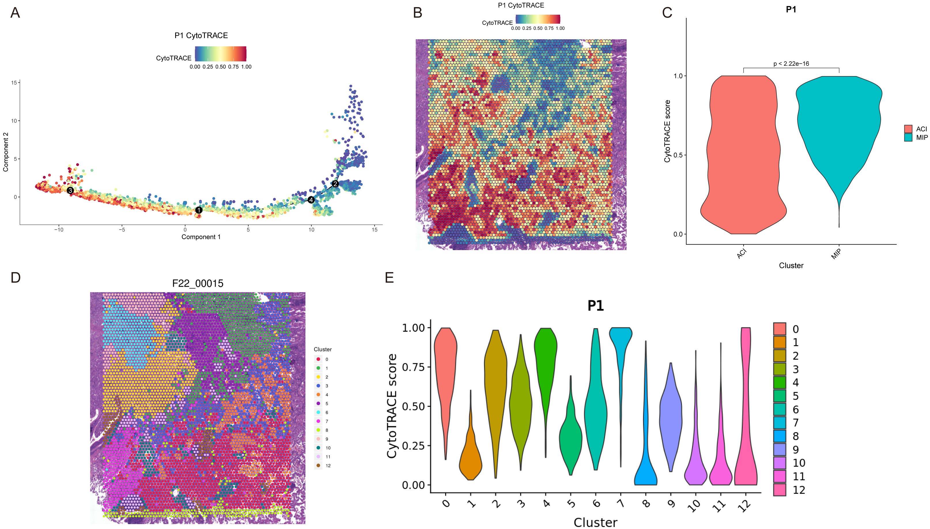 Panel A depicts a scatter plot showing CytoTRACE scores across two components with a color gradient. Panel B shows a hexagonal grid map representing CytoTRACE scores on a tissue section. Panel C is a violin plot comparing CytoTRACE scores between two clusters, ACI and MIP, with a significant p-value. Panel D provides another hexagonal grid map indicating different clusters within a tissue section. Panel E is a violin plot displaying CytoTRACE scores across multiple clusters, color-coded from zero to twelve.