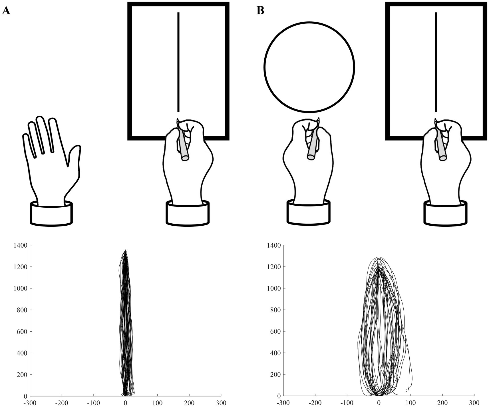 Panel A illustrates the unimanual condition, where a participant uses their preferred hand to repeatedly draw vertical lines on a tablet PC. The bottom subpanel shows actual drawing traces from an 8-year-old right-handed female participant, demonstrating straight vertical movements. Panel B depicts the bimanual condition, in which the participant simultaneously draws vertical lines with their preferred hand and circles with their non-preferred hand. The bottom subpanel shows the resulting distorted trajectory from the same participant, reflecting ovalization due to bimanual motor interference.