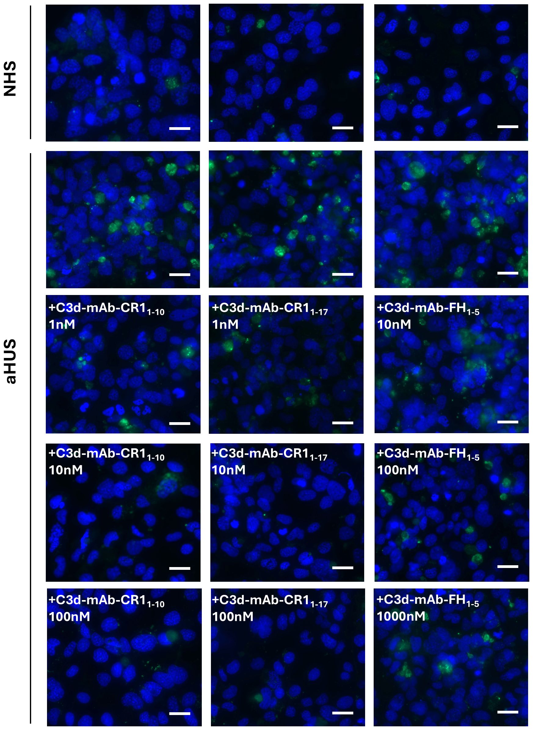 Fluorescent microscopy images of cells showing blue nuclei and green-stained areas, organized in a grid. The top row labeled “NHS” shows minimal green fluorescence. The remaining rows labeled “aHUS” depict varying levels of green fluorescence with different treatments: +C3d-mAb-CR1 and +C3d-mAb-FH across three concentrations (1 nanomolar, 10 nanomolar, 100 nanomolar). Each image has a scale bar indicating size reference.