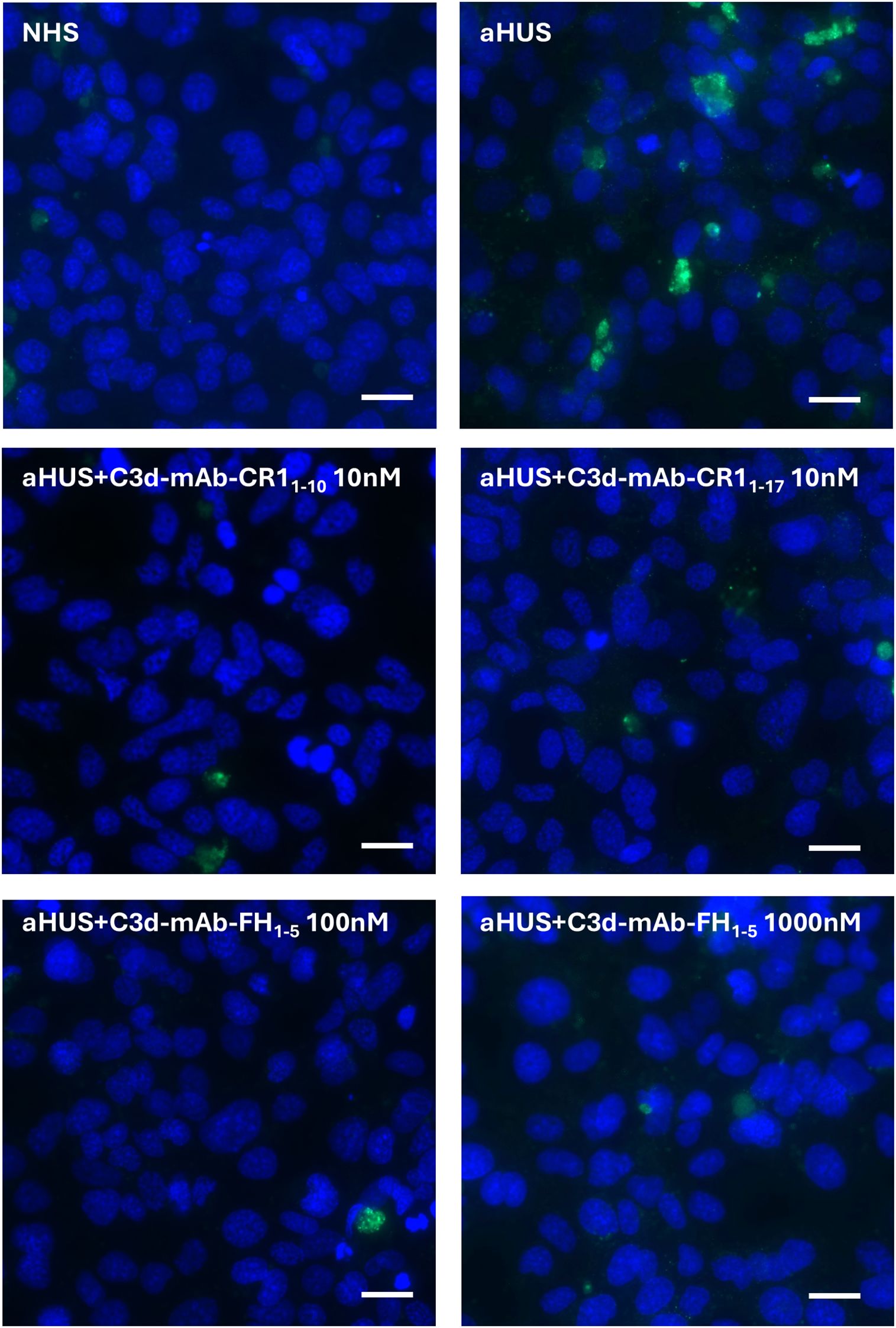 Fluorescent microscopy images show blue-stained cells with varying levels of green fluorescence. Top left: NHS shows minimal green. Top right: aHUS shows increased green fluorescence. Middle row: aHUS with C3d-mAb-CR1 variations at 10 nanomolar, showing different green intensities. Bottom row: aHUS with C3d-mAb-FH variations at 100 and 1000 nanomolar, showing minimal green fluorescence. Scale bars are included.