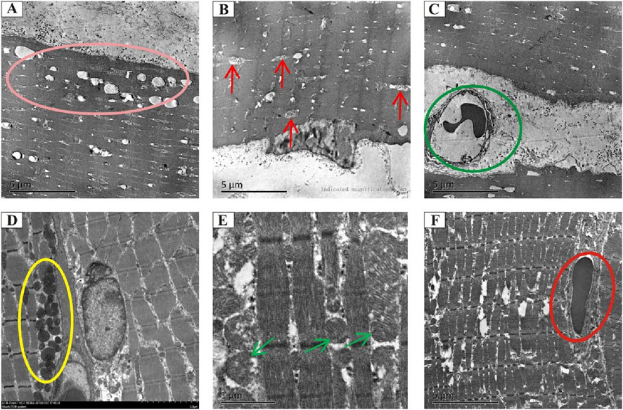 Electron microscopy images labeled A to F depict various cellular structures with colored annotations highlighting specific features. Image A shows a pink oval highlighting a cluster of structures. Image B features red arrows pointing to linear features. Image C has a green circle around an oval shape. Image D includes a yellow oval encircling dense particles. Image E contains green arrows indicating linear patterns. Image F displays a red oval around an elongated structure. Each image includes a scale bar for size reference.