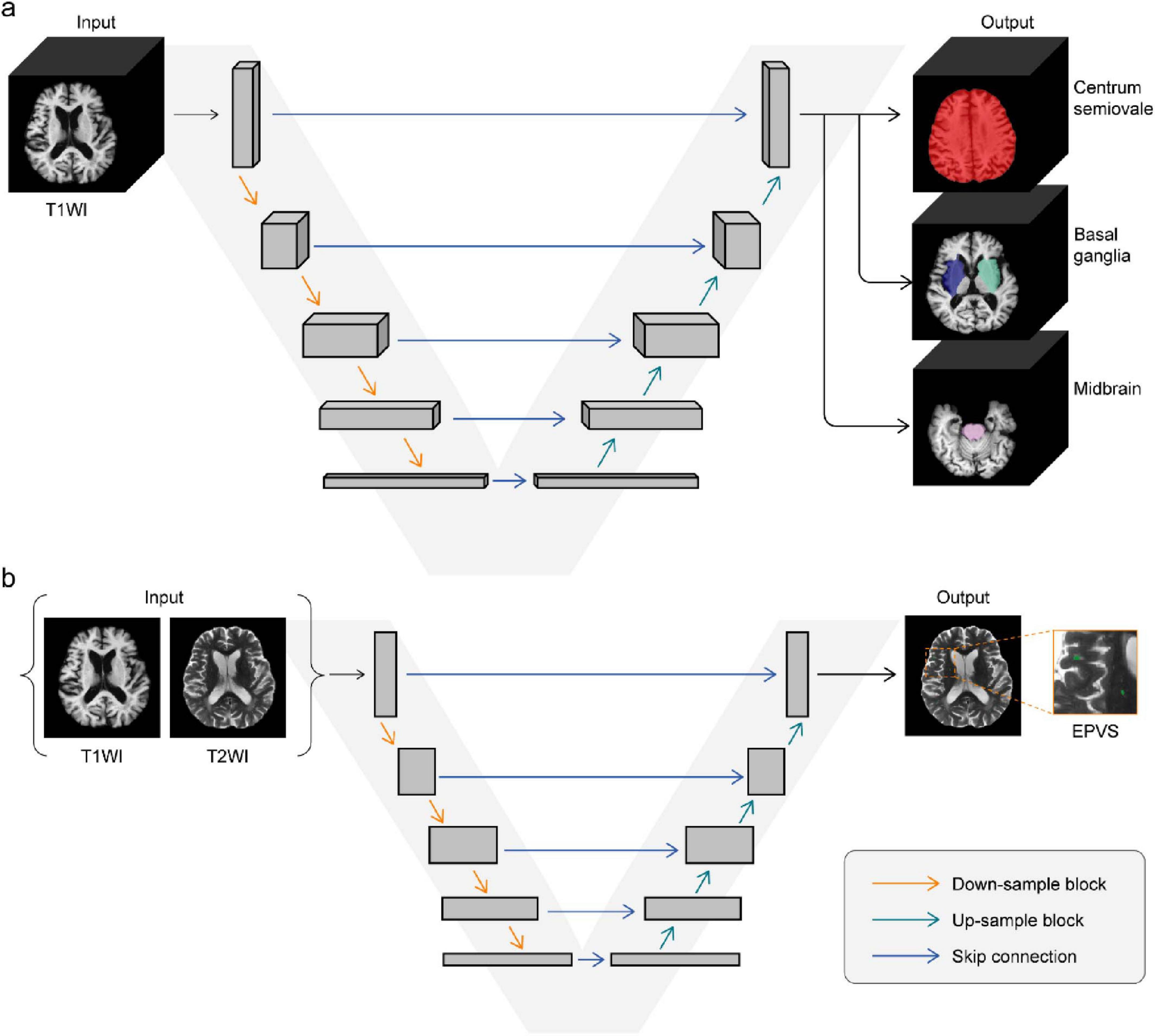 Diagram showing two neural network architectures. Part (a) depicts a network processing a T1-weighted MRI input, outputting segmentation maps for the centrum semiovale, basal ganglia, and midbrain. Part (b) illustrates a network using both T1-weighted and T2-weighted MRIs as input, outputting enhanced perivascular spaces (EPVS). Arrows denote down-sampling, up-sampling, and skip connections, with a legend explaining each.