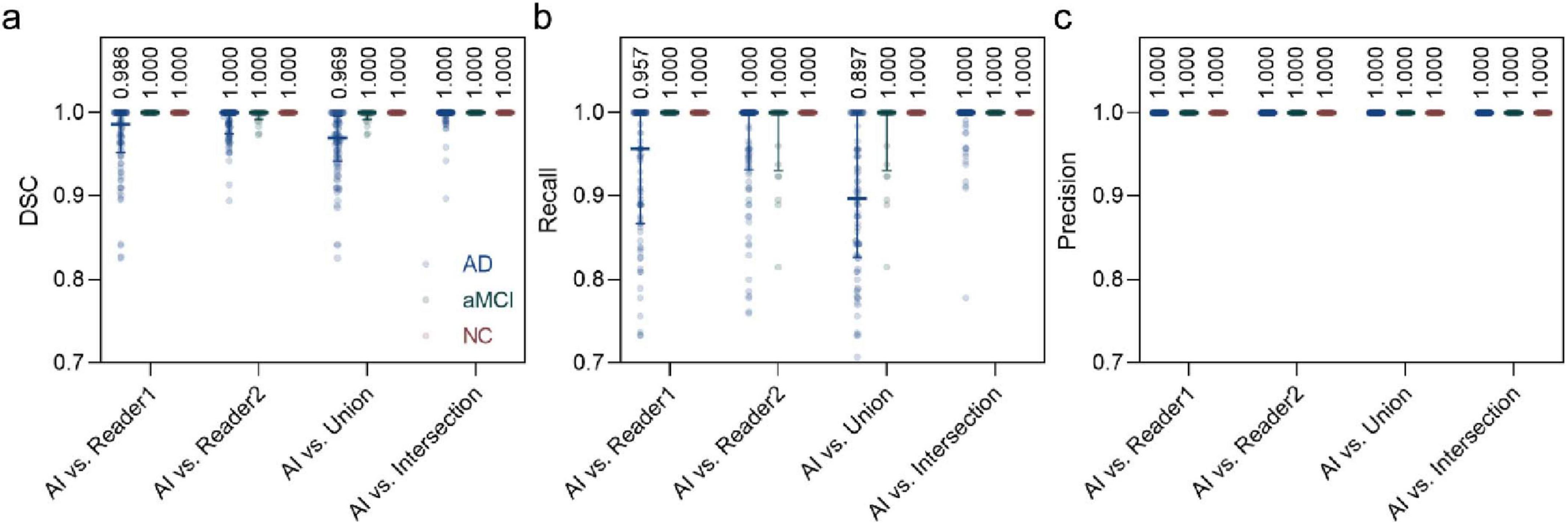 Three graphs depict comparison metrics between AI and human readers in three categories: DSC, Recall, and Precision. Graph (a) shows DSC values close to one for AI vs. Reader 1, Reader 2, Union, and Intersection for conditions AD, aMCI, and NC. Graph (b) shows Recall, also consistently near one across all comparisons. Graph (c) shows Precision achieving a perfect score of one for all conditions and comparisons.