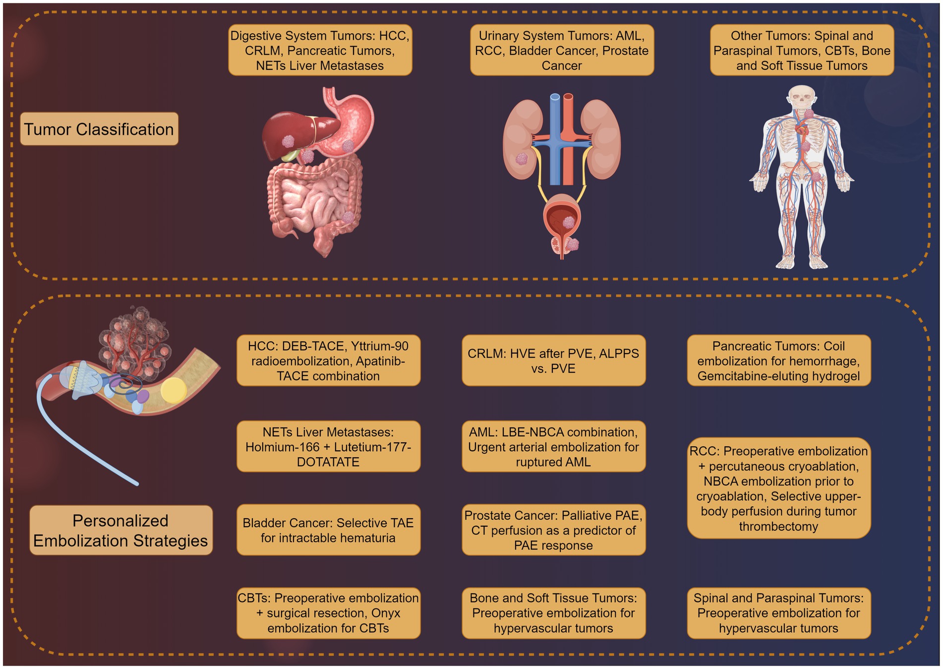 Diagram showing tumor classification and personalized embolization strategies. Top section depicts digestive, urinary, other tumors with related systems. Bottom section details treatment strategies for each tumor type, including HCC, NETs liver metastases, bladder cancer, and others.