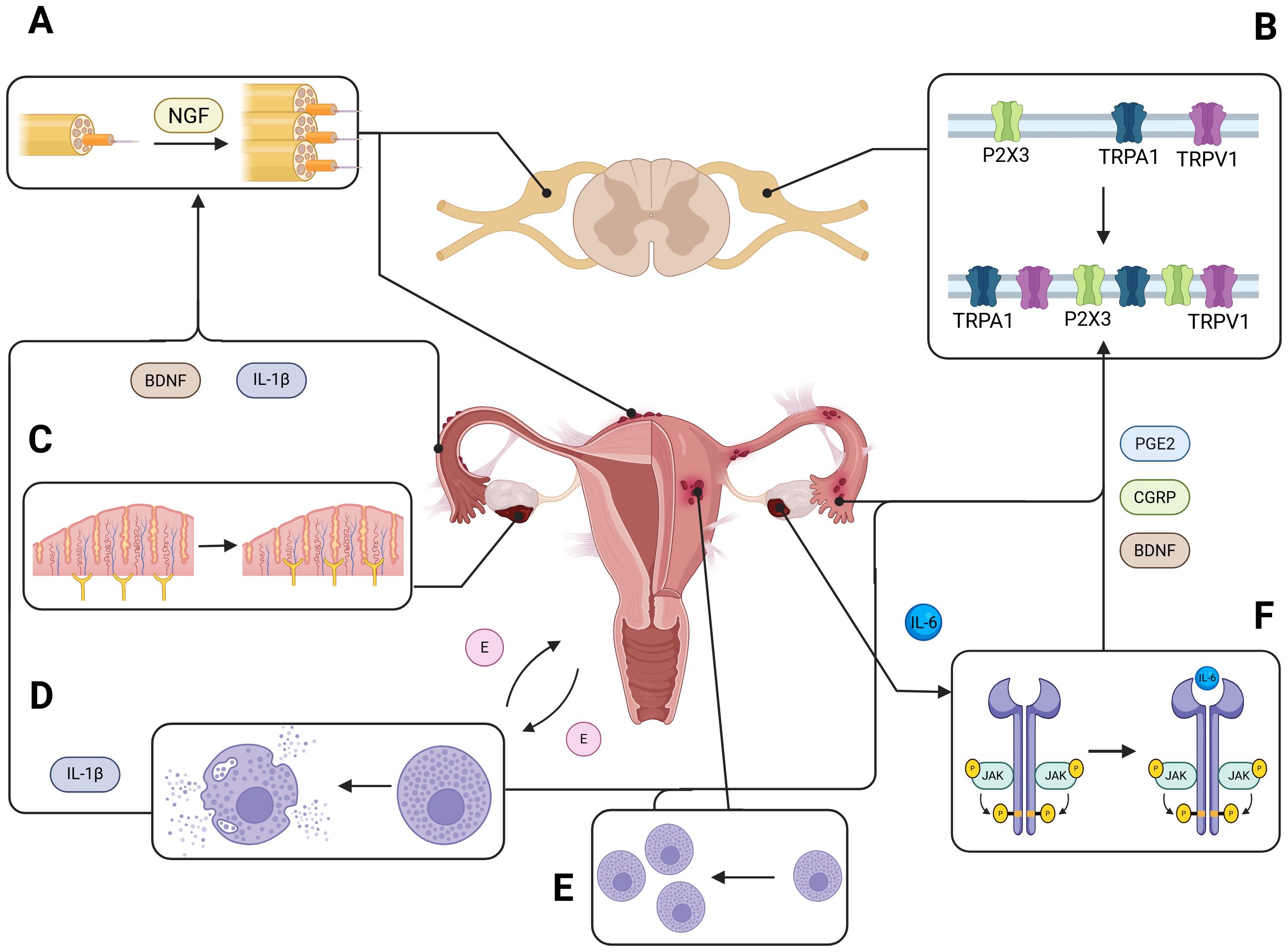 Diagram illustrating the interaction between the nervous, immune system and endometriosis lesions. It includes sections labeled A to F. A shows how mediators promote nerve fibres sprouting in lesions, B depicts ion channel regulation in DRGs of endometriosis patients, C illustrates hyperinnervation of endometriosis lesions, D shows increased degranulation of mast cells, E refers to increased infiltration of mast cells and F indicates IL-6 driven increase in JAK Kinase signalling. B depicts receptors P2X3, TRPA1, and TRPV1. C illustrates endometrial changes. D shows interleukin 1 beta (IL-1ÎČ) effects on cells. E refers to estrogen (E) and cell interaction. F indicates cytokine pathways involving prostaglandin E2 (PGE2), calcitonin gene-related peptide (CGRP), brain-derived neurotrophic factor (BDNF), interleukin 6 (IL-6), and Janus kinase (JAK). Central focus is a uterus with highlighted endometrial lesions.