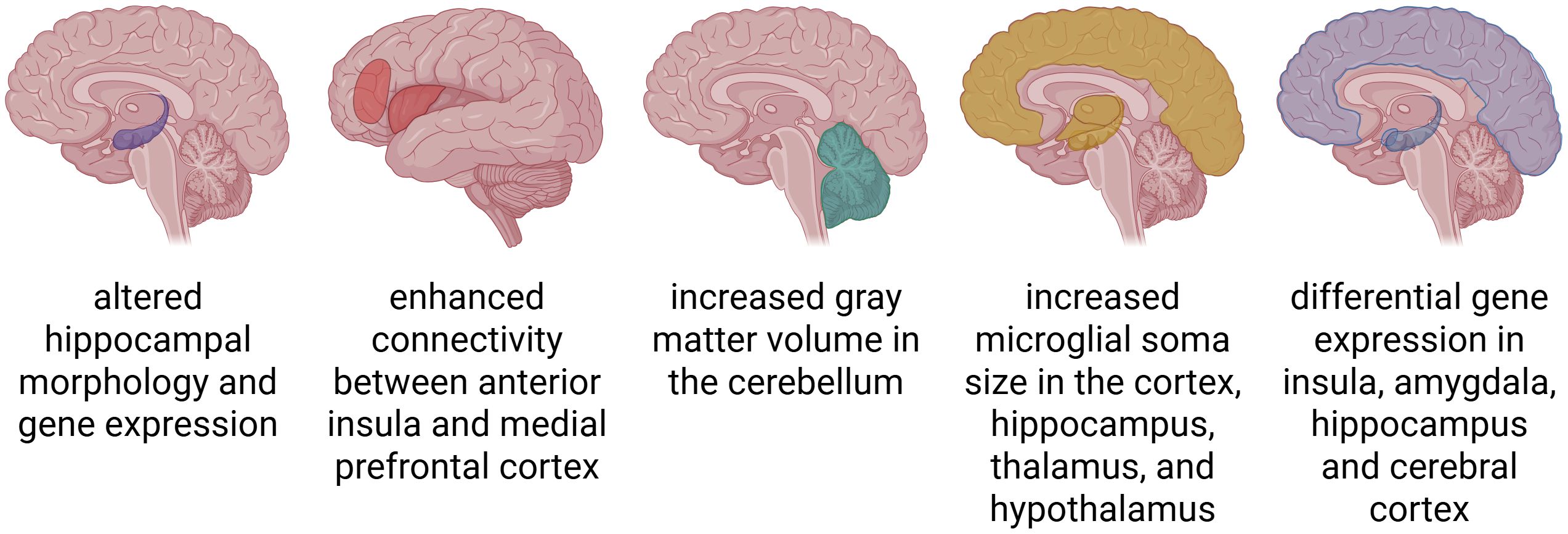 Illustration of five brain sections highlighting different areas with accompanying text. From left to right: First, hippocampus with âaltered hippocampal morphology and gene expression
