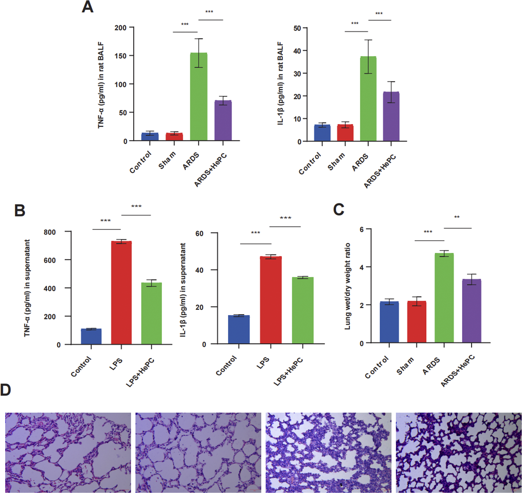 Graphs and images depict the effects of treatments on inflammatory markers and lung morphology. Panel A shows bar graphs of TNF-α and IL-1β levels in rat BALF across different groups, indicating higher levels in ARDS compared to control. Panel B displays TNF-α and IL-1β levels in supernatant, showing significant increases in LPS-treated samples. Panel C illustrates the lung wet/dry weight ratio, higher in ARDS. Panel D features histological images of lung tissue from different groups, highlighting structural changes. Asterisks indicate statistical significance.