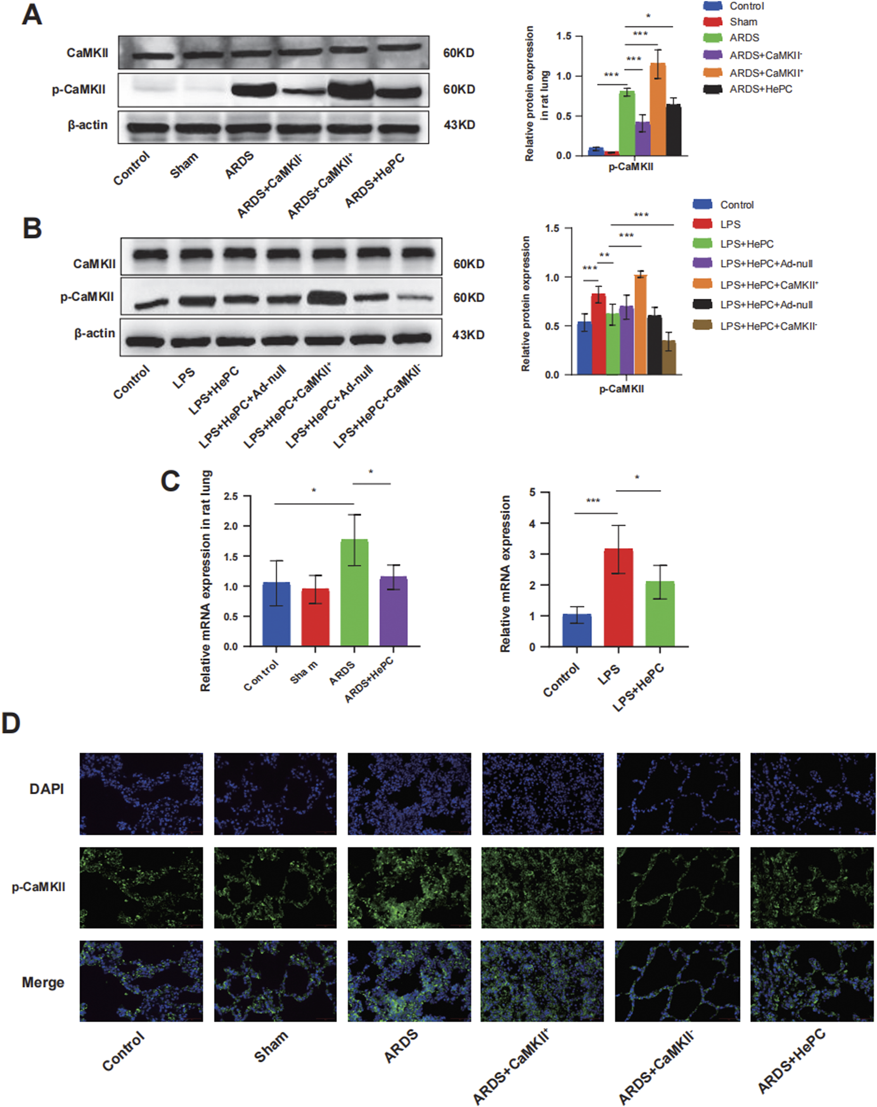 Western blot and bar graph results depict the expression levels of CaMKII and p-CaMKII proteins under different conditions including ARDS, with statistical significance marked by asterisks. Immunofluorescence images display the expression of these proteins in rat lung tissue, with DAPI staining used for cell nuclei visualization. The experiments compare various treatments, including Sham and LPS with modifications such as HePC and CaMKII variants. The images provide insights into the expression and localization of proteins related to lung injury and potential therapies.