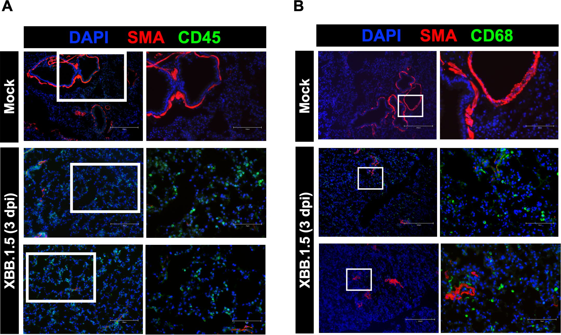 Fluorescent microscopy images show tissue sections stained with DAPI (blue), SMA (red), and CD45 or CD68 (green). Panel A and B compare “Mock” with “XBB.1.5 (3 dpi)” samples. In both panels, “Mock” sections display higher red intensity indicative of SMA, while “XBB.1.5 (3 dpi)” sections show increased green staining, indicating higher CD45 or CD68 expression. White boxes highlight specific tissue regions.