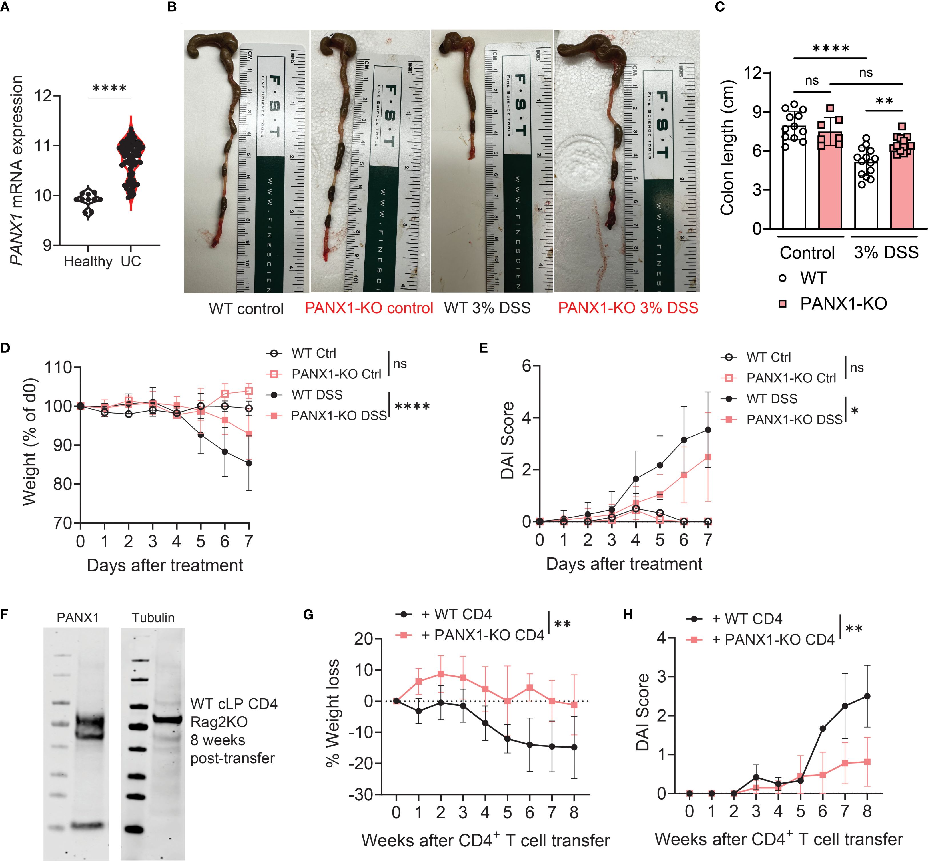 A scientific figure with eight panels (A-H) showing results from experiments.   (A) Violin plot comparing PANX1 mRNA expression in healthy versus ulcerative colitis (UC) patients. (B) Images of colons from four experimental groups: WT control, PANX1-KO control, WT 3% DSS, PANX1-KO 3% DSS. (C) Bar graph showing colon lengths with statistical significance indicated. (D) Line graph of weight percentages over seven days post-treatment in four conditions: WT Ctrl, PANX1-KO Ctrl, WT DSS, PANX1-KO DSS. (E) Line graph of Disease Activity Index (DAI) scores over seven days for the same conditions as (D). (F) Western blot for PANX1 and Tubulin. (G) Line graph of percentage weight loss over eight weeks after CD4+ T cell transfer in WT and PANX1-KO. (H) Line graph of DAI scores over eight weeks in the same groups as (G).