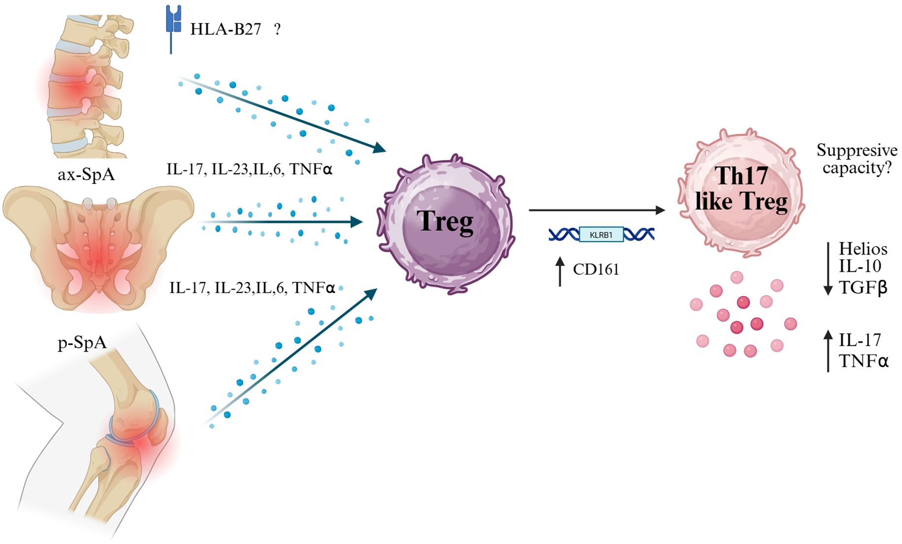 Diagram showing the interaction between axial and peripheral spondyloarthritis (ax-SpA and p-SpA) with Treg and Th17-like Treg cells. HLA-B27 and cytokines IL-17, IL-23, IL-6, and TNFα influence Treg cells. CD161 and KLRB1 affect Th17-like Treg, with uncertain suppressive capacity. Helios, IL-10, TGFβ, IL-17, and TNFα are indicated. Red shaded areas highlight inflammation.