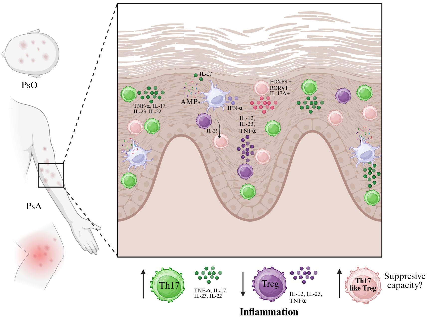 Illustration showing the inflammatory process in psoriasis (PsO) and psoriatic arthritis (PsA). It highlights Th17 cells, regulatory T cells (Treg), cytokines like TNF-α, IL-17, IL-23, IL-22, and their roles in inflammation. The graphic depicts cellular interactions in skin layers, focusing on immune cell activity and signaling molecules. It includes diagrams of affected skin and joints to represent symptom locations.