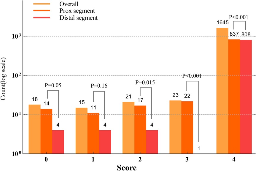 Bar chart displaying counts on a logarithmic scale for scores 0 to 4, categorized by overall, proximal segment, and distal segment. Overall counts are highest at score 4 with a significant difference (p<0.001). Lesser counts are observed at lower scores with varying p-values.