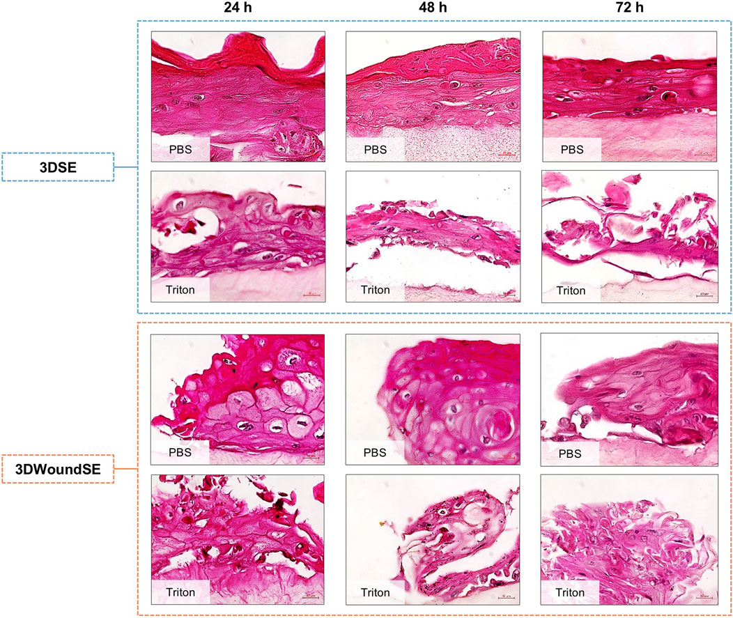 Microscopic images of 3DSE and 3DWoundSE at 24, 48, and 72 hours. Each set is treated with PBS or Triton. The images show varying tissue structures and cellular details stained in pink.