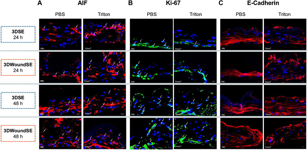 Microscopic images showing 3D skin equivalents over 24 and 48 hours with different treatments. Staining shows AIF in red, Ki-67 in green, and E-Cadherin in red, with nuclei in blue. Panels contrast PBS and Triton treatments across two timeframes. Arrows point to areas of interest.
