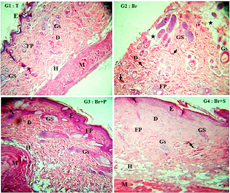 Four histological images labeled G1: T, G2: Br, G3: Br+P, and G4: Br+S, showing tissue with different structures. Each panel contains labels for epidermis (E), dermis (D), muscle (M), hair follicle (H), fat pad (FP), glandular structure (GS), and various arrows and stars pointing to specific areas within the tissues.