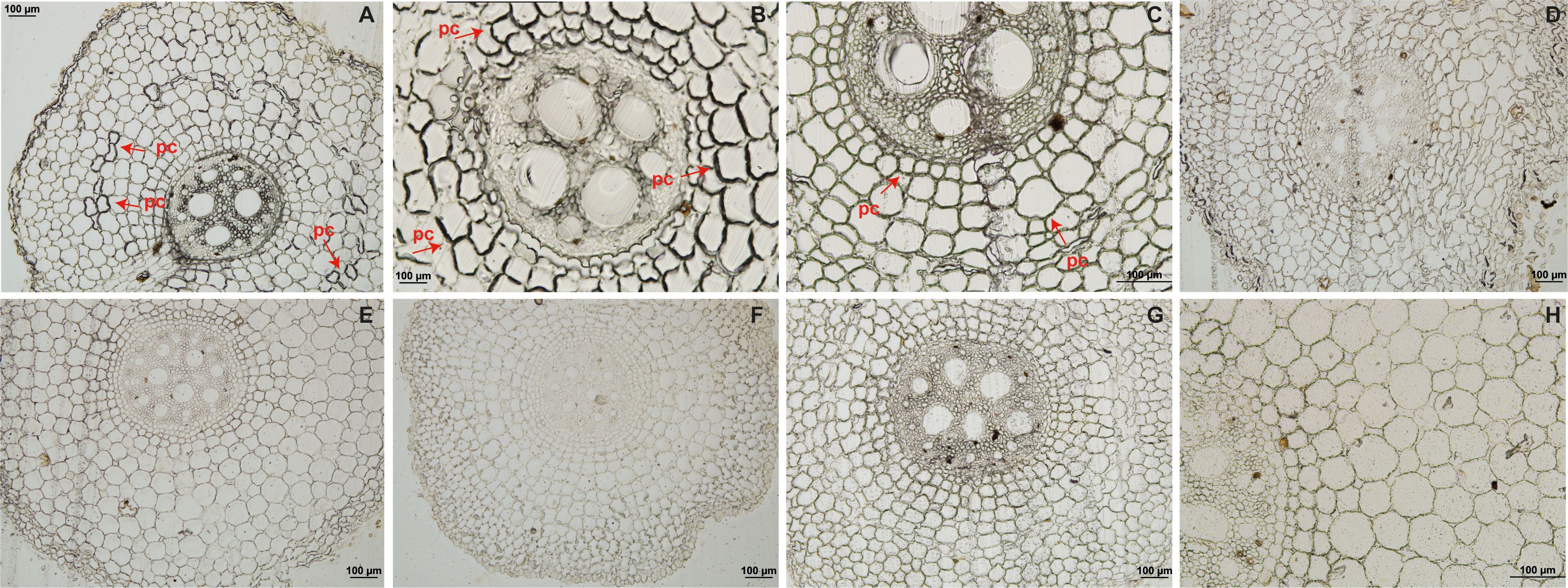 Microscopic images of plant pseudostem cross-sections in banana accessions Calcutta 4 and Prata-Anã labeled A to H. Each section shows varying degrees of phenolic compound deposition. Red arrows labeled “pc” point to specific cells with phenolic compounds. Scale bars indicate 100 micrometers.