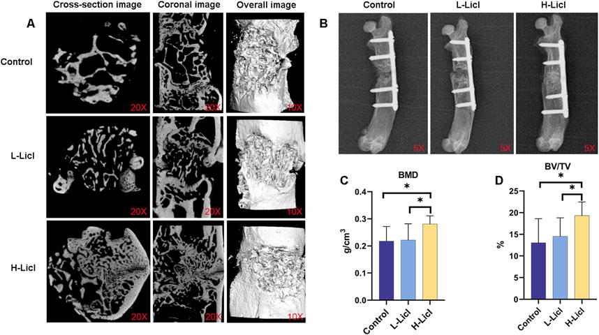 Panel A shows cross-section, coronal, and overall images of bone under control, low, and high lithium chloride (LiCl) conditions at different magnifications. Panel B displays radiographic images of bones under the same conditions at 5X magnification. Panel C presents a bar graph comparing bone mineral density (BMD) across the three conditions, with higher values in the H-LiCl group. Panel D shows a bar graph of bone volume to total volume (BV/TV) percentage, indicating increases in the LiCl groups, particularly H-LiCl. Stars indicate statistical significance.