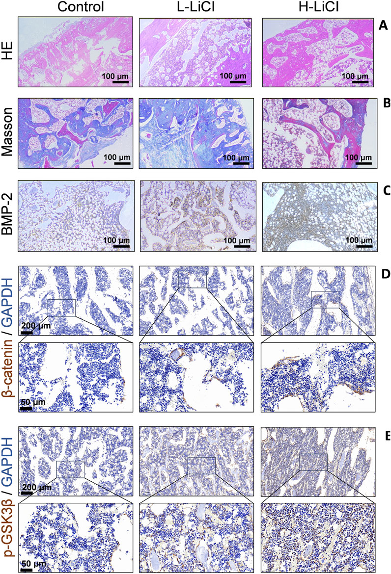 Histological images showing three treatments: Control, L-LiCl, and H-LiCl. Panel A shows HE staining, Panel B Masson's trichrome, and Panel C BMP-2 immunostaining. Panels D and E depict β-catenin/GAPDH and p-GSK3β/GAPDH staining, respectively, with magnified sections highlighting cellular details. Each image includes a scale bar for reference.