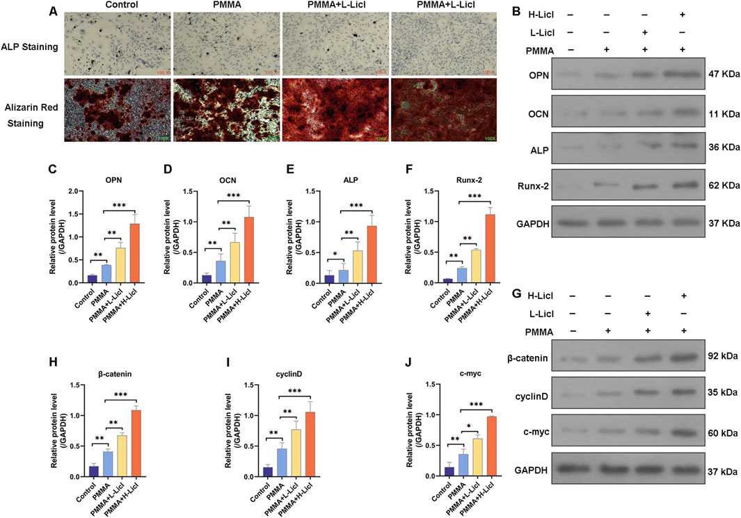 Microscopic images and bar graphs showing the effects of different treatments (Control, PMMA, PMMA with low-LiCl, PMMA with high-LiCl) on cell staining and protein levels. ALP and Alizarin Red staining images illustrate cell differentiation. Bar graphs (C-J) depict relative protein levels, with significant differences indicated. Western blots (B, G) show expression of specific proteins: OPN, OCN, ALP, Runx-2, β-catenin, cyclin D, and c-myc, with GAPDH as a loading control.