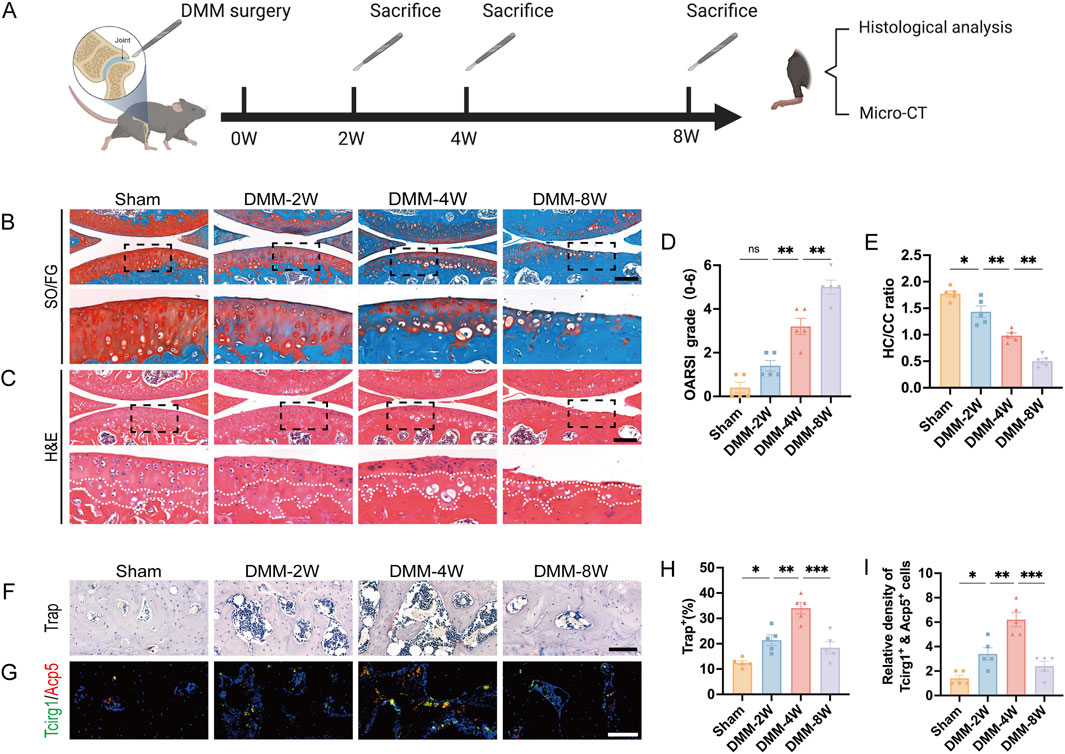 Diagram detailing a research study on the effects of DMM (destabilization of the medial meniscus) surgery in mice examined over a span of eight weeks. Part A shows a timeline of the experimental procedure post-surgery at zero, two, four, and eight weeks, followed by histological analysis and Micro-CT. Parts B and C display histological sections stained with Safranin O/Fast Green and Hematoxylin & Eosin at various time points. Part D presents a bar graph of OARSI grades over time. Part E shows a bar graph for HC/CC ratio. Parts F and G display TRAP and Tcf1g1/Acp5 staining, with corresponding bar charts (H and I) showing Trap positive percentages and Tcf1g1/Ac5 positive cell densities over the duration. Statistical significance is indicated with asterisks.
