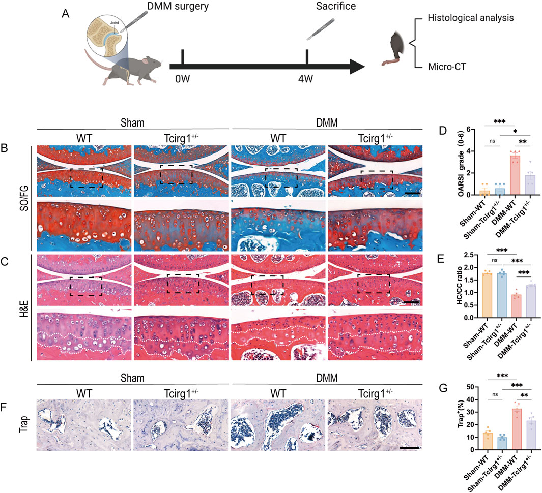 Schematic of the study design and analysis of joint tissues following surgery. Panel A shows a timeline of DMM surgery and histological analysis. Panels B and C display joint tissue stained with Safranin O/Fast Green and Hematoxylin and Eosin, respectively, comparing WT and Tcirg1^+/- mice under Sham and DMM conditions. Panel D presents a bar graph with OARSI grades, while Panel E shows the HC/CC ratio, each comparing different groups. Panel F illustrates TRAP staining, and panel G features a bar graph indicating percentage of TRAP positivity across the groups. Statistical significance is marked by asterisks.