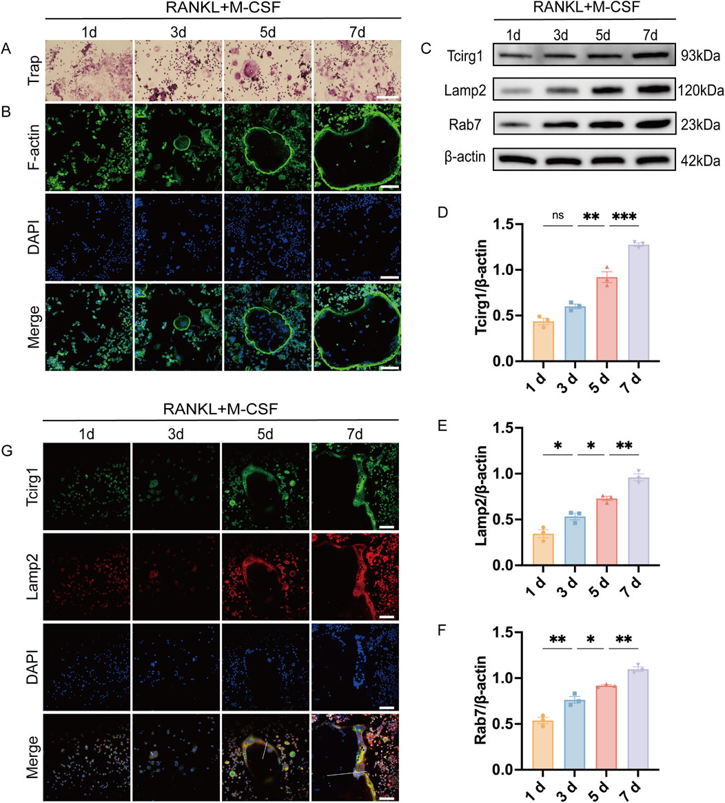 Experimental data showing the effects of RANKL and M-CSF over time. Panels A and G display microscopy images of cell samples stained with various markers at 1, 3, 5, and 7 days. Panel B shows F-actin, DAPI, and merged staining. Panel C includes Western blot bands for Tcirg1, Lamp2, Rab7, and β-actin. Panels D, E, and F present bar graphs of protein expression levels at different days, indicating statistical significance with * symbols. Scale bars are present in the microscopy images.
