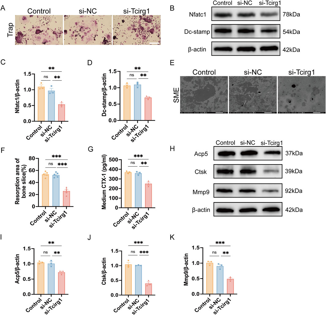 Panels display various analyses comparing control, si-NC, and si-Tcirg1 groups. Panel A shows microscopic images of trap staining. Panel B displays Western blot results for Nfatc1, Dc-stamp, and β-actin. Panels C, D, F, G, I, J, and K show bar graphs illustrating gene expression and protein levels, with statistical significance denoted by asterisks. Panel E presents scanning electron microscope images. Panel H shows Western blot results for Acp5, Ctsk, Mmp9, and β-actin. The images and graphs collectively highlight differences in expression and activity related to osteoclast function.